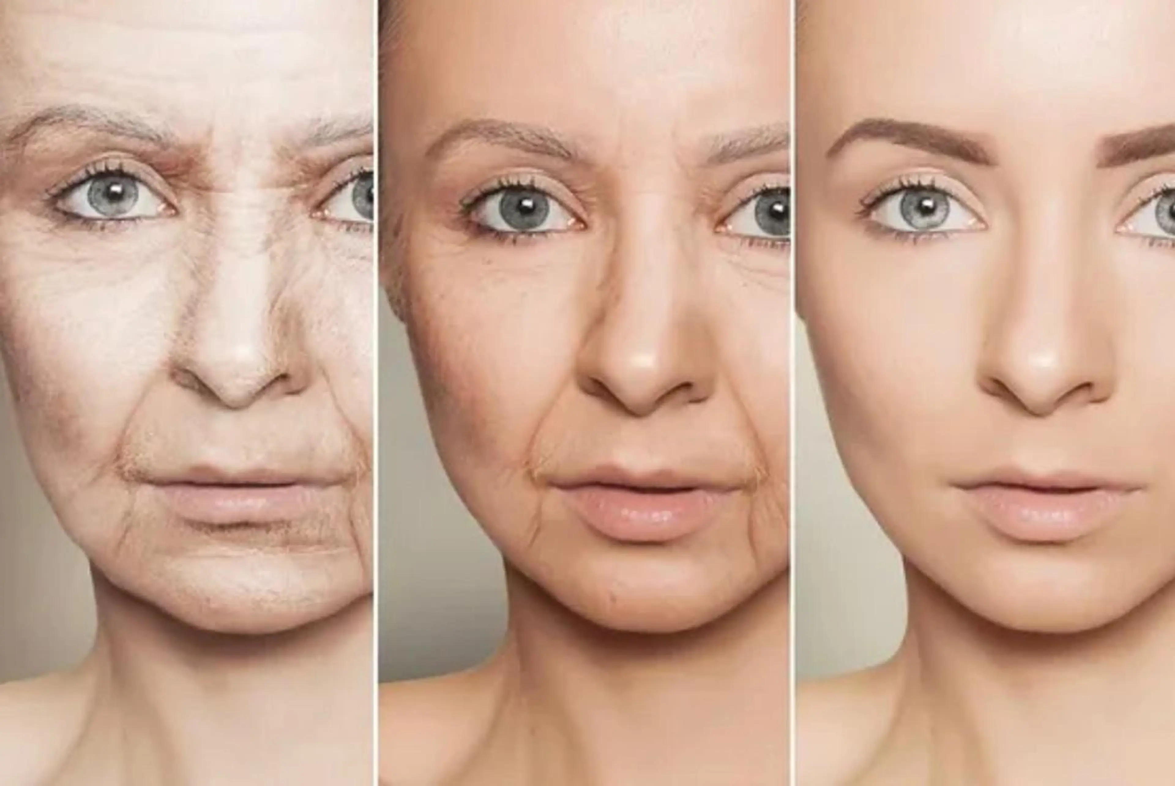 イーライトフェイシャル《シミ・しわ・赤ら顔・ニキビ跡に効果が見られるアイシングフェイシャル》の写真