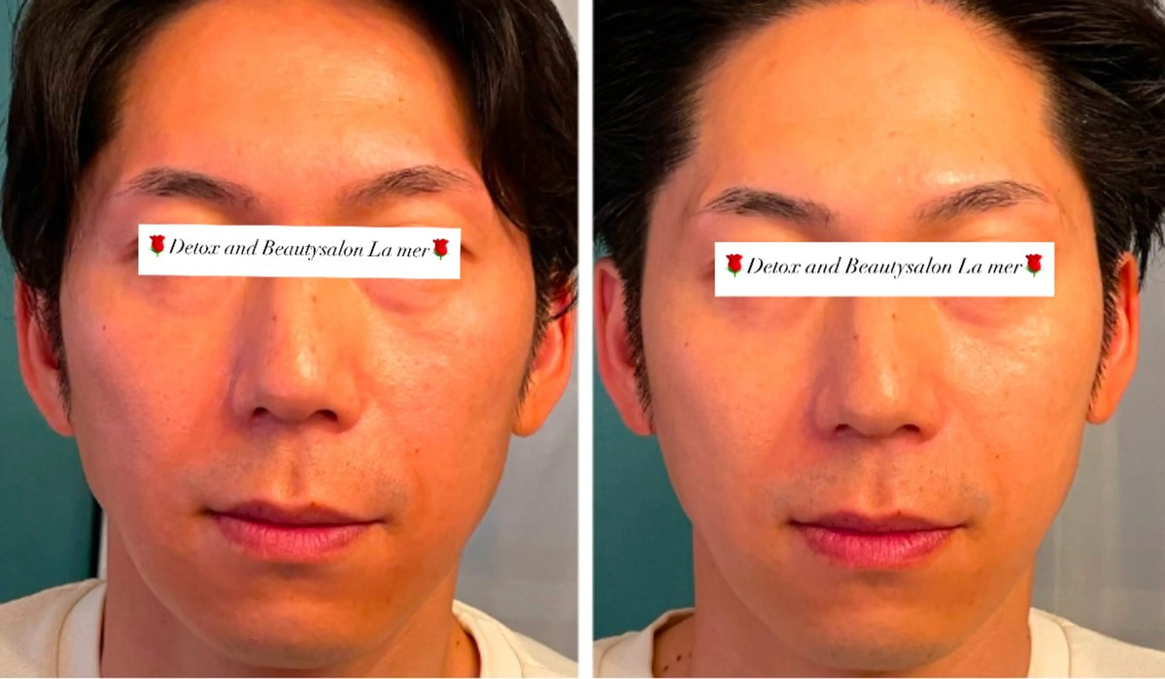 エステ 耳ツボ/体質改善/ 温活La mer月島のその他イメージ