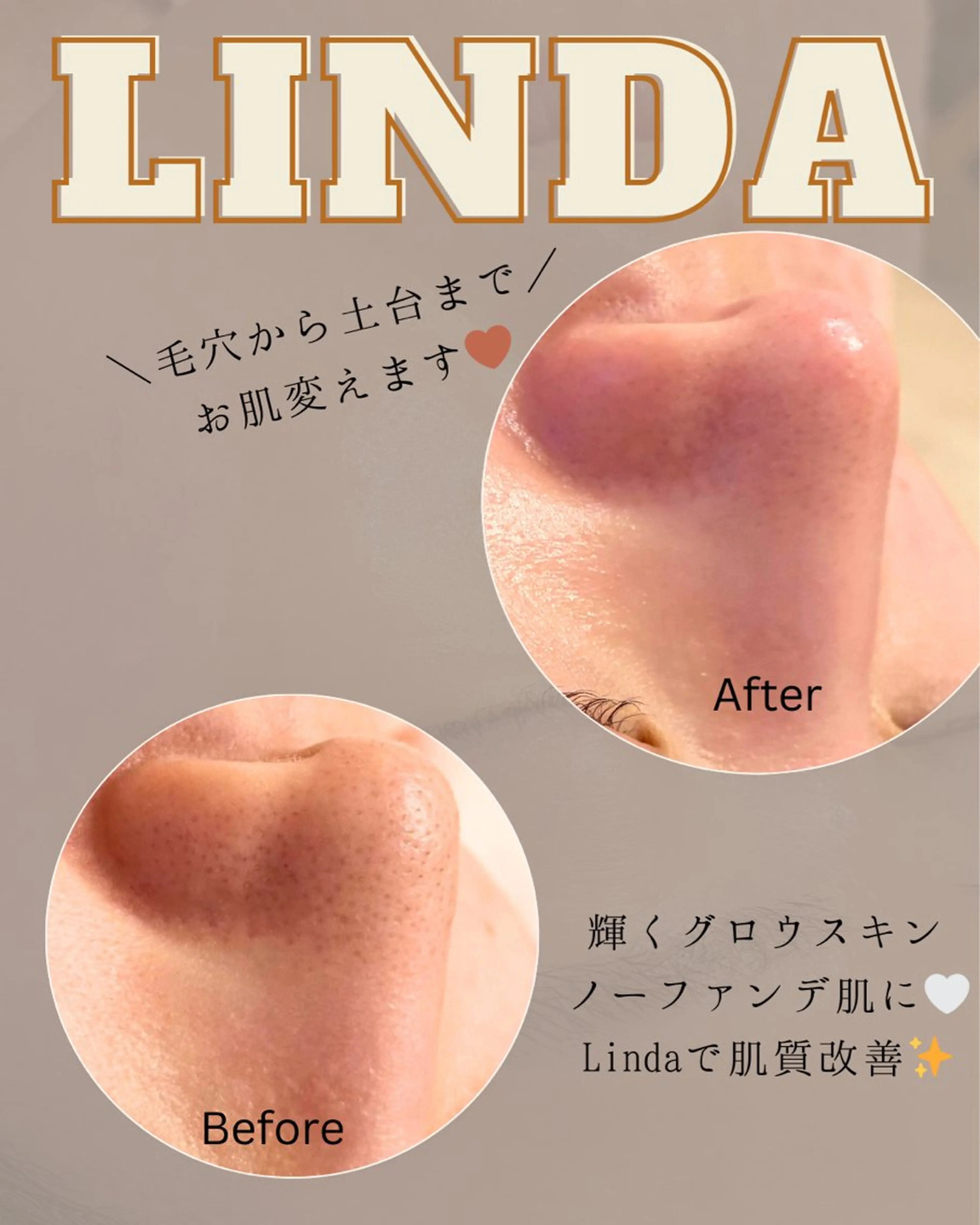 エステ 小顔&毛穴・肌質改善 LINDA西宮 AIのエステ・リラクイメージ