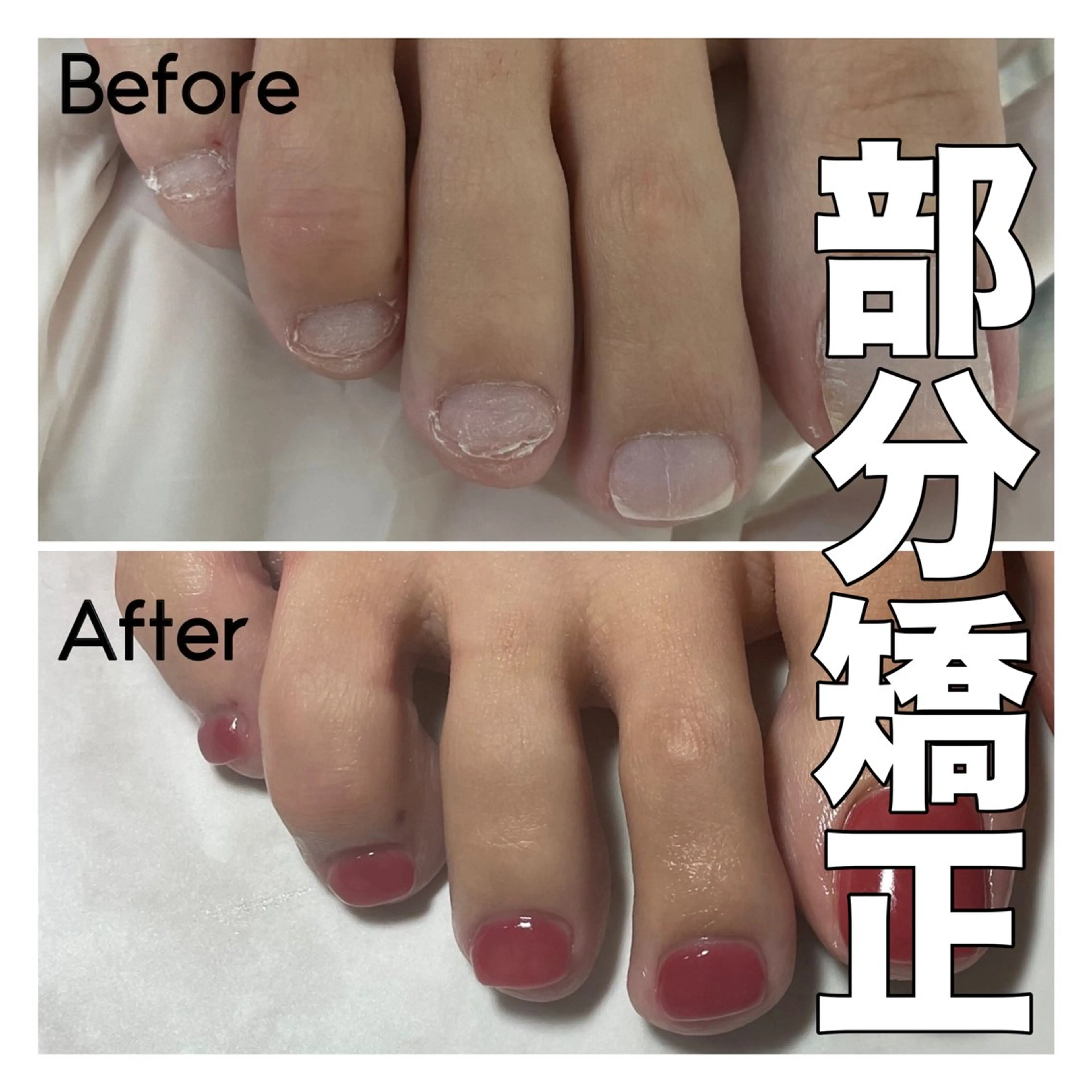 ネイル 長さ出し フットネイル nail salon petillantのネイルデザイン