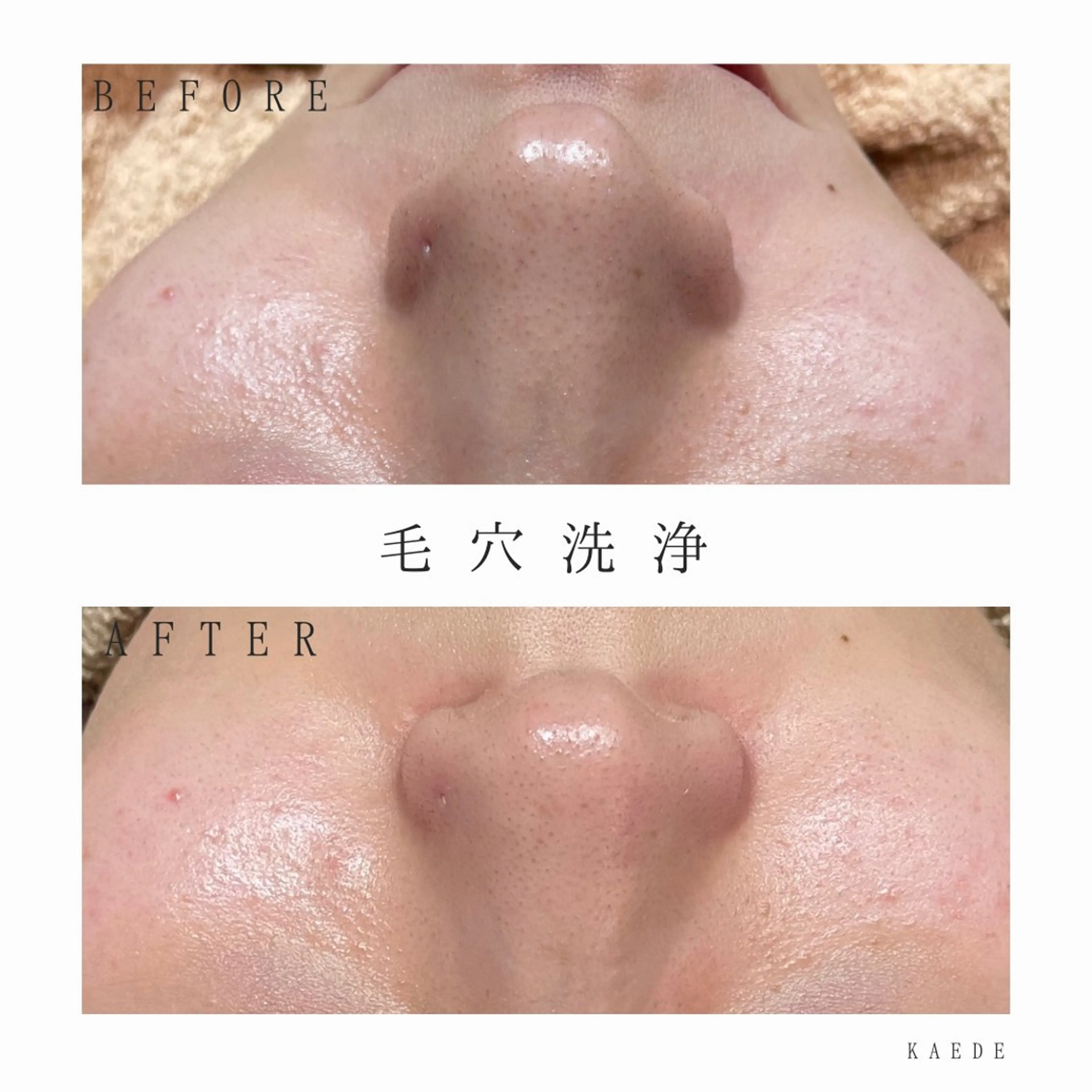 🎀kaede🎀 骨格似合わせ眉毛の眉毛・アイブロウイメージ