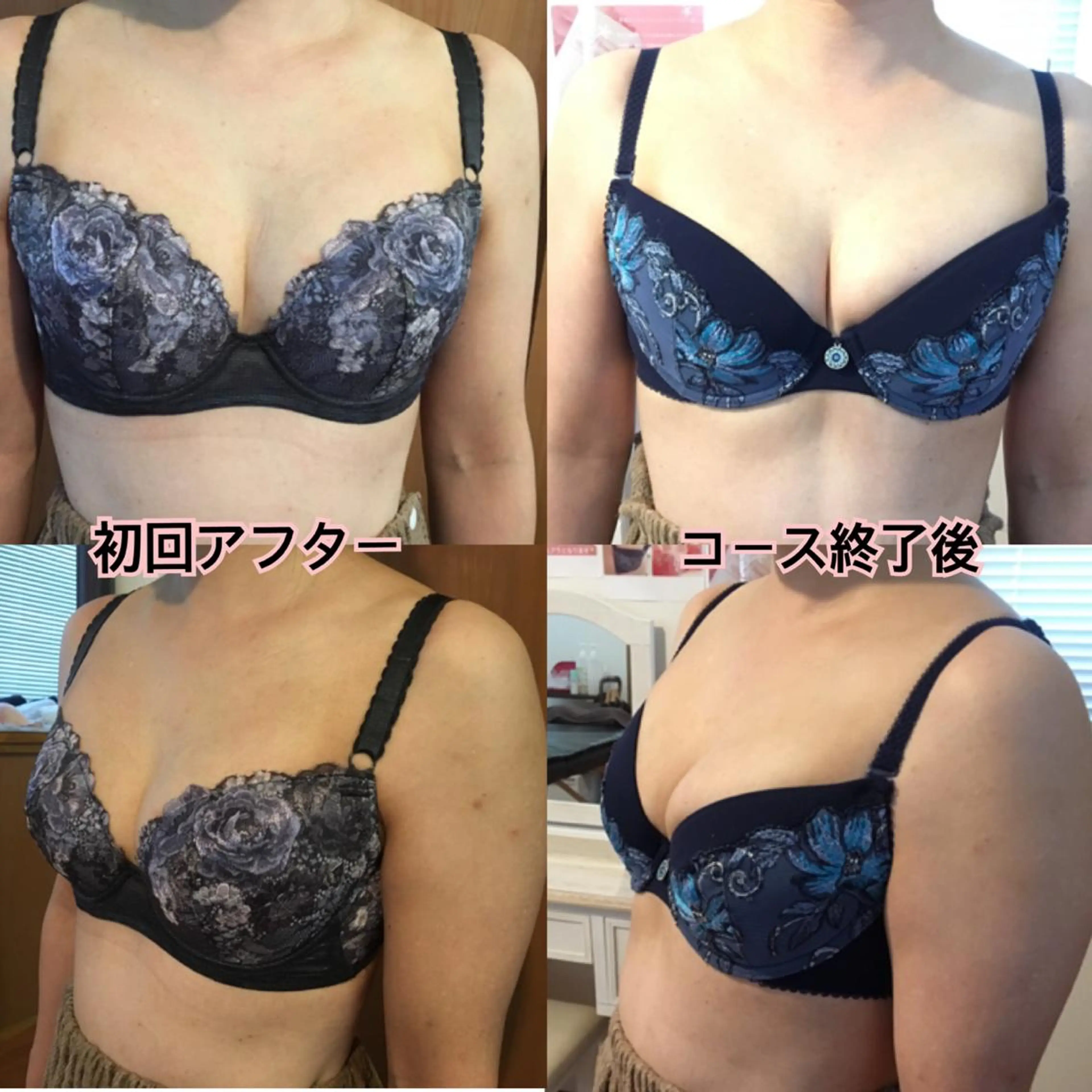 バストアップサロン エミルカのその他イメージ