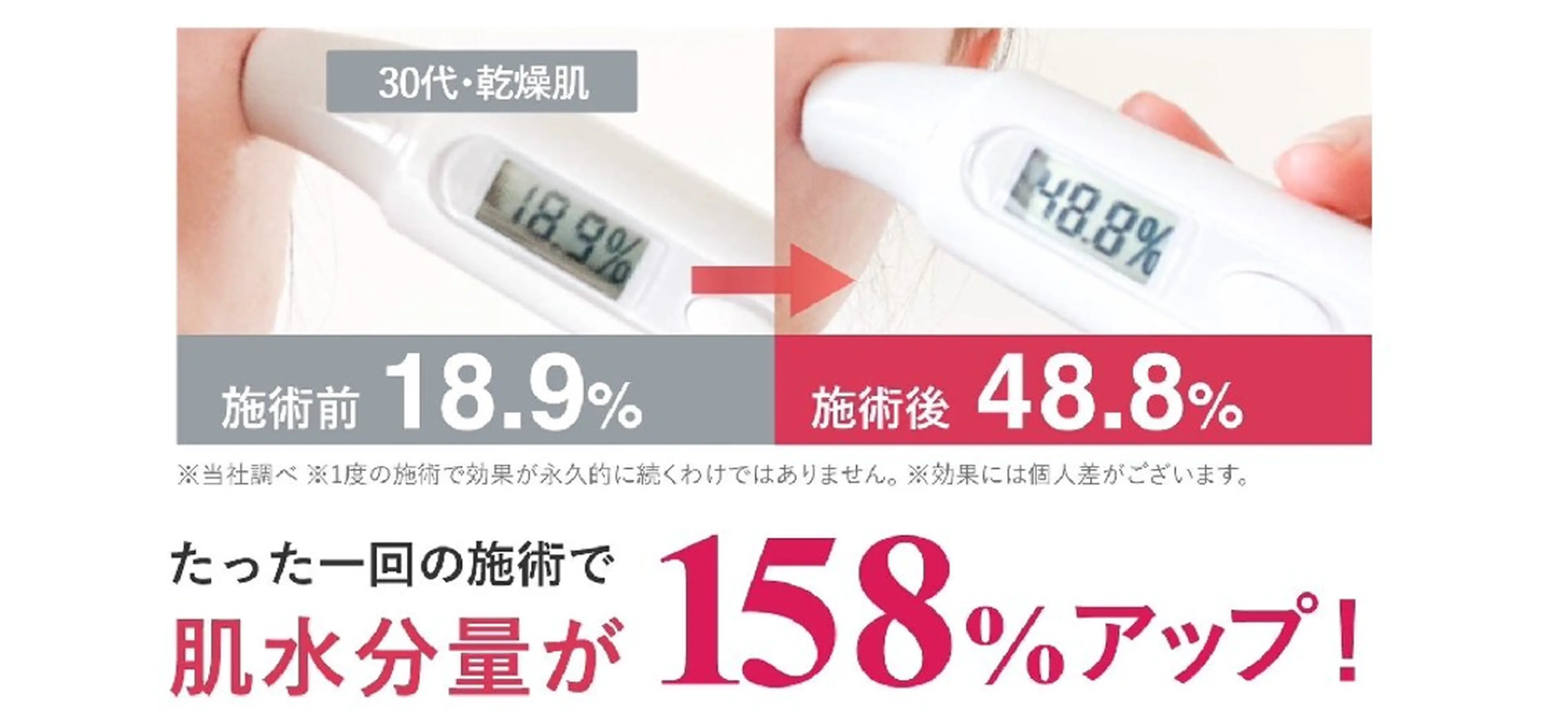 小顔リフトアップ専門 サロン／ダリア 大分のエステ・リラクイメージ