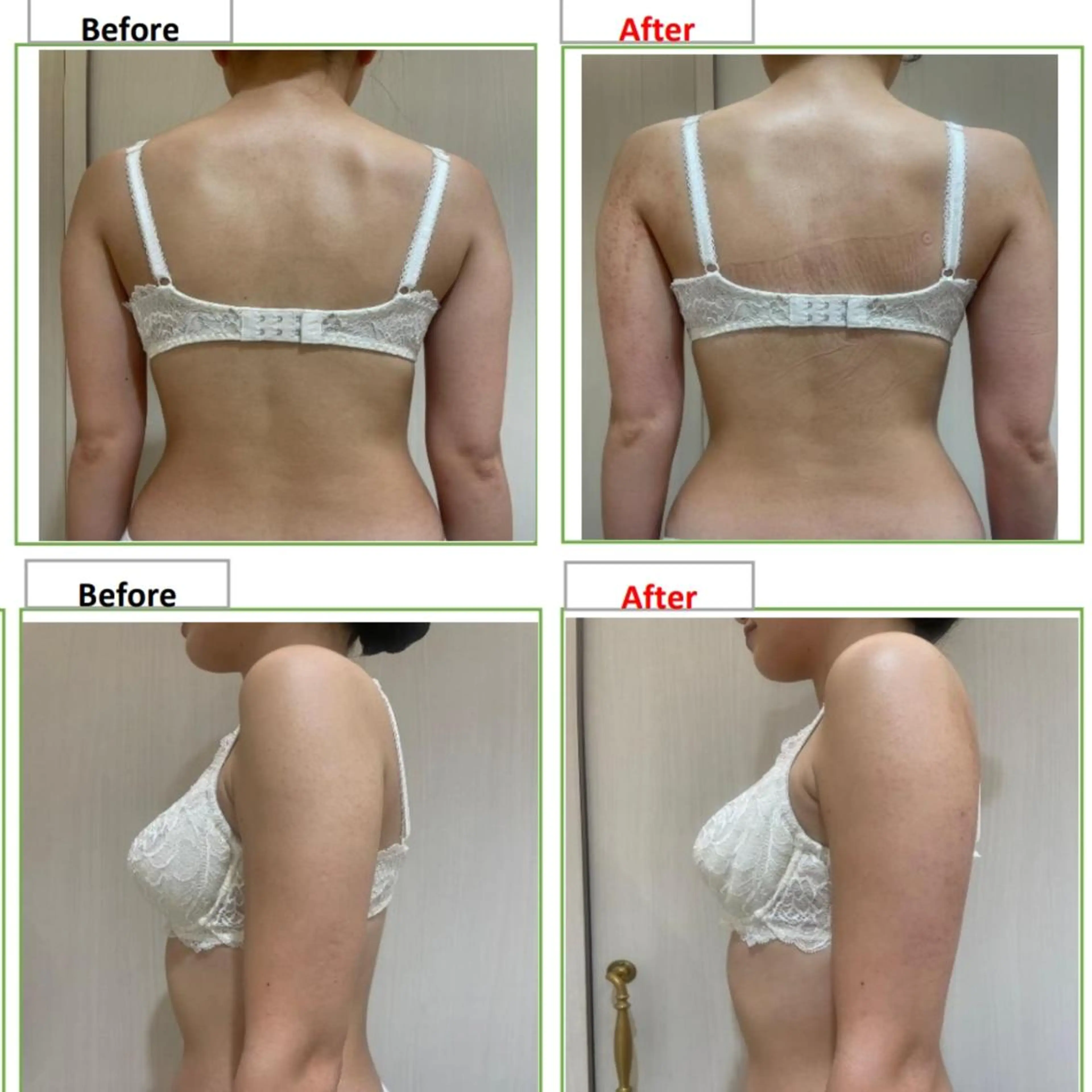 エステ 創業40周年✨美肌サ ロンRAYVIS銀座のエステ・リラクイメージ