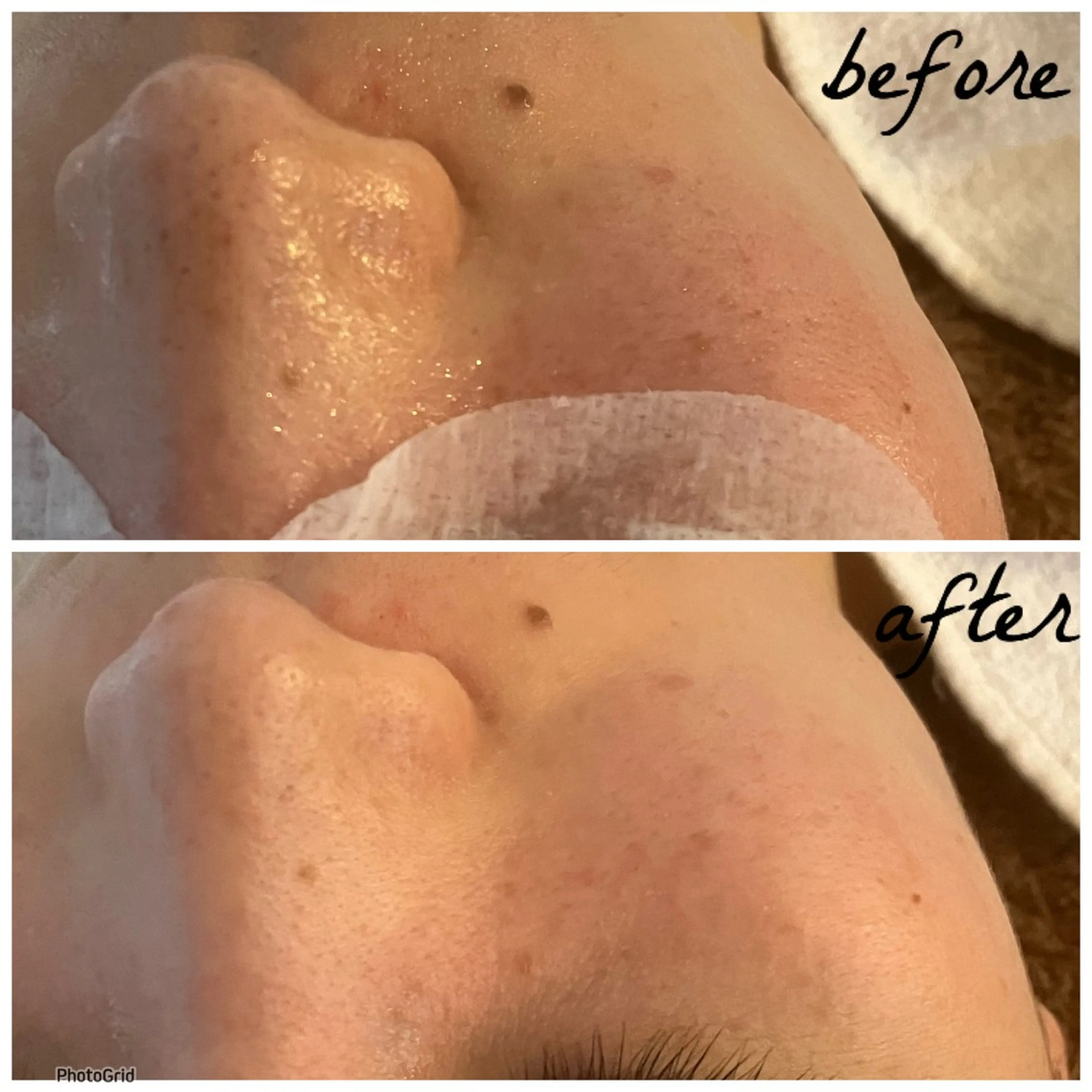 メンズ エステ メナード岐阜市茜部 杉浦のエステ・リラクイメージ