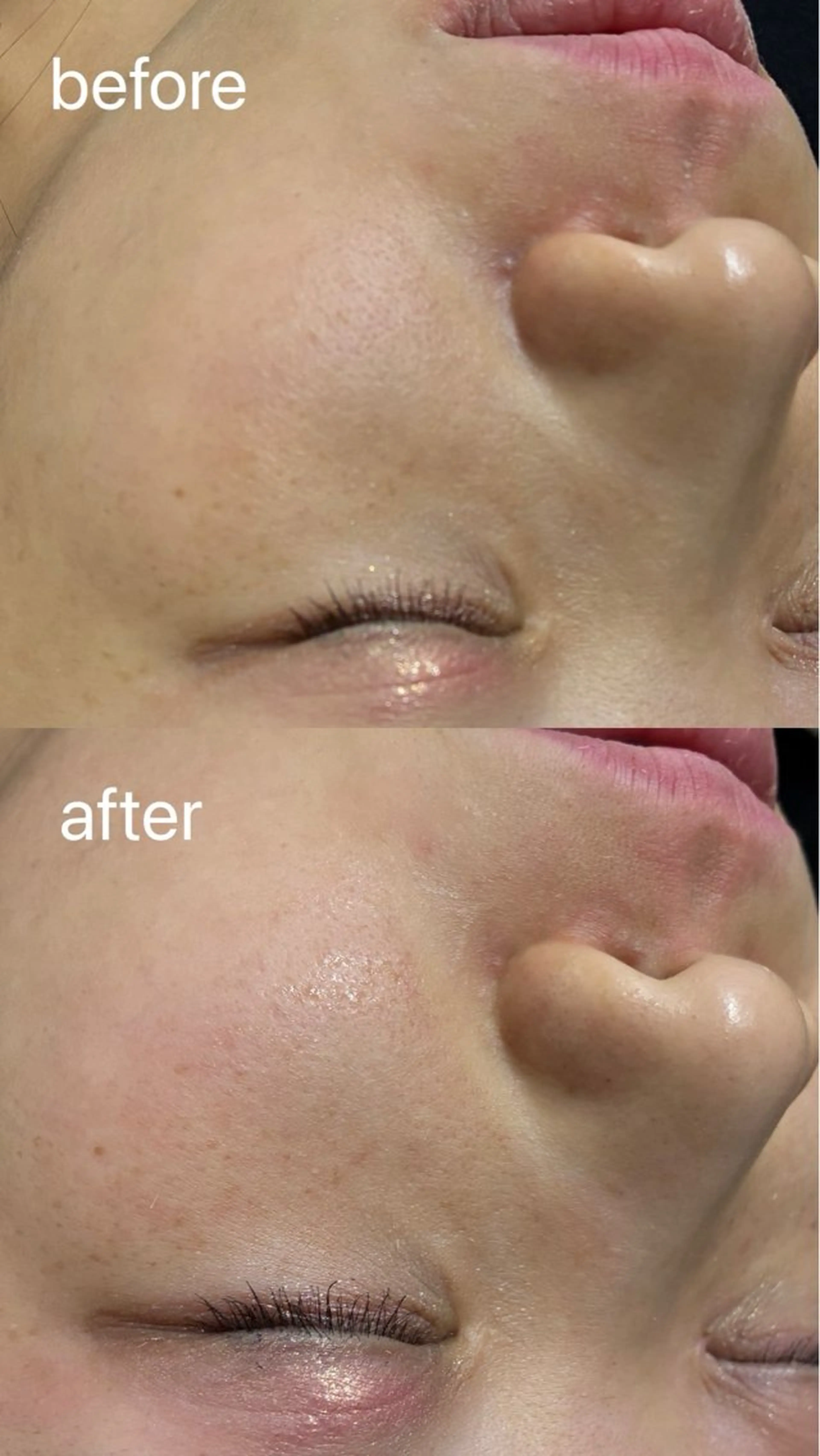 エステ smile nail スマイルネイルのその他イメージ