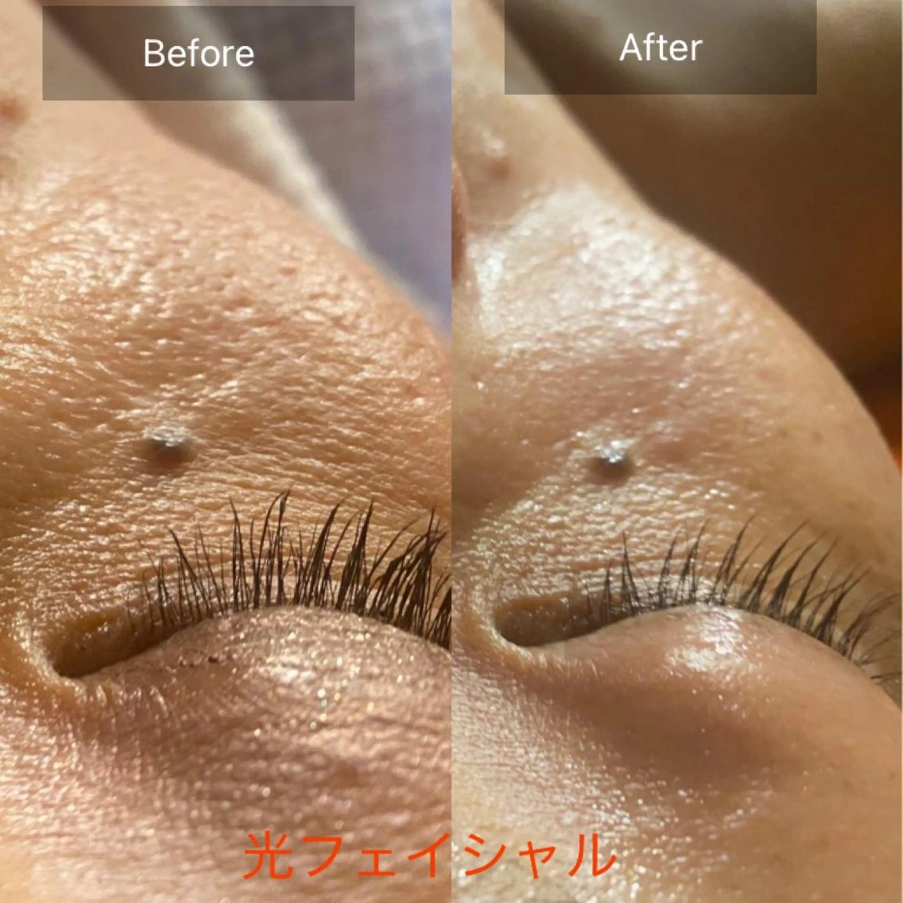 エステ 毛穴から始める肌メン テマンダリンオレンジのエステ・リラクイメージ