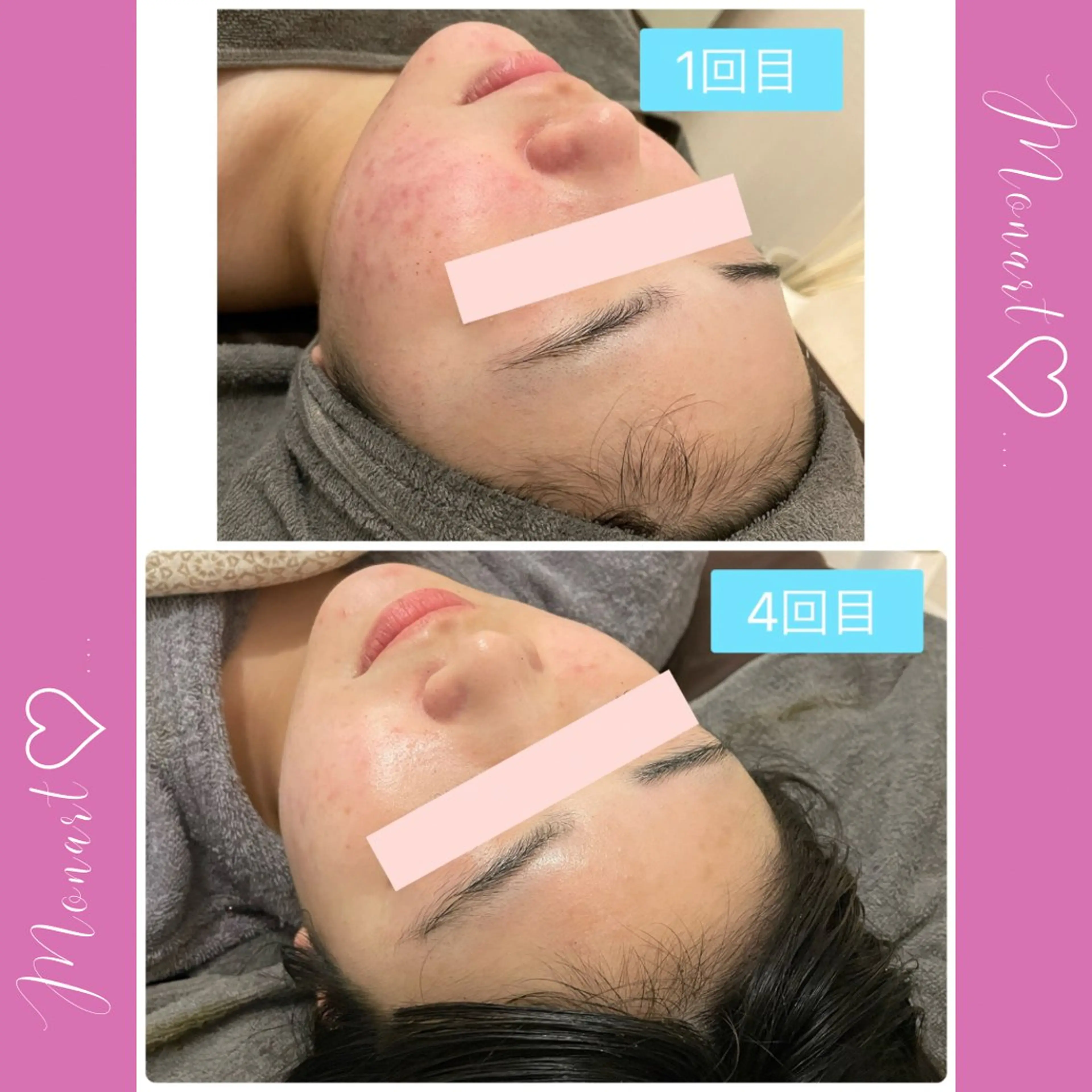 Monart -deux-のエステ・リラクイメージ