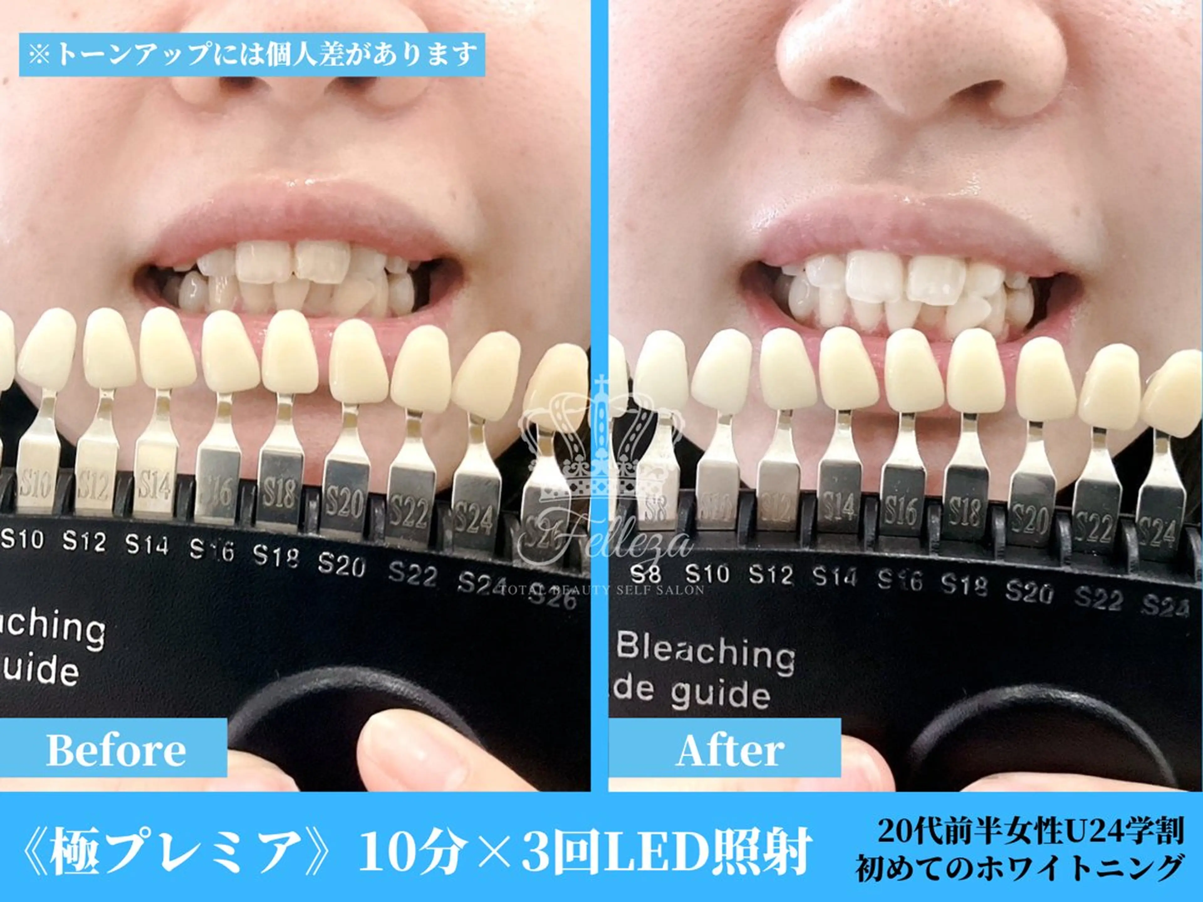 有人型セルフサロン 脱毛／痩身／美顔のエステ・リラクイメージ