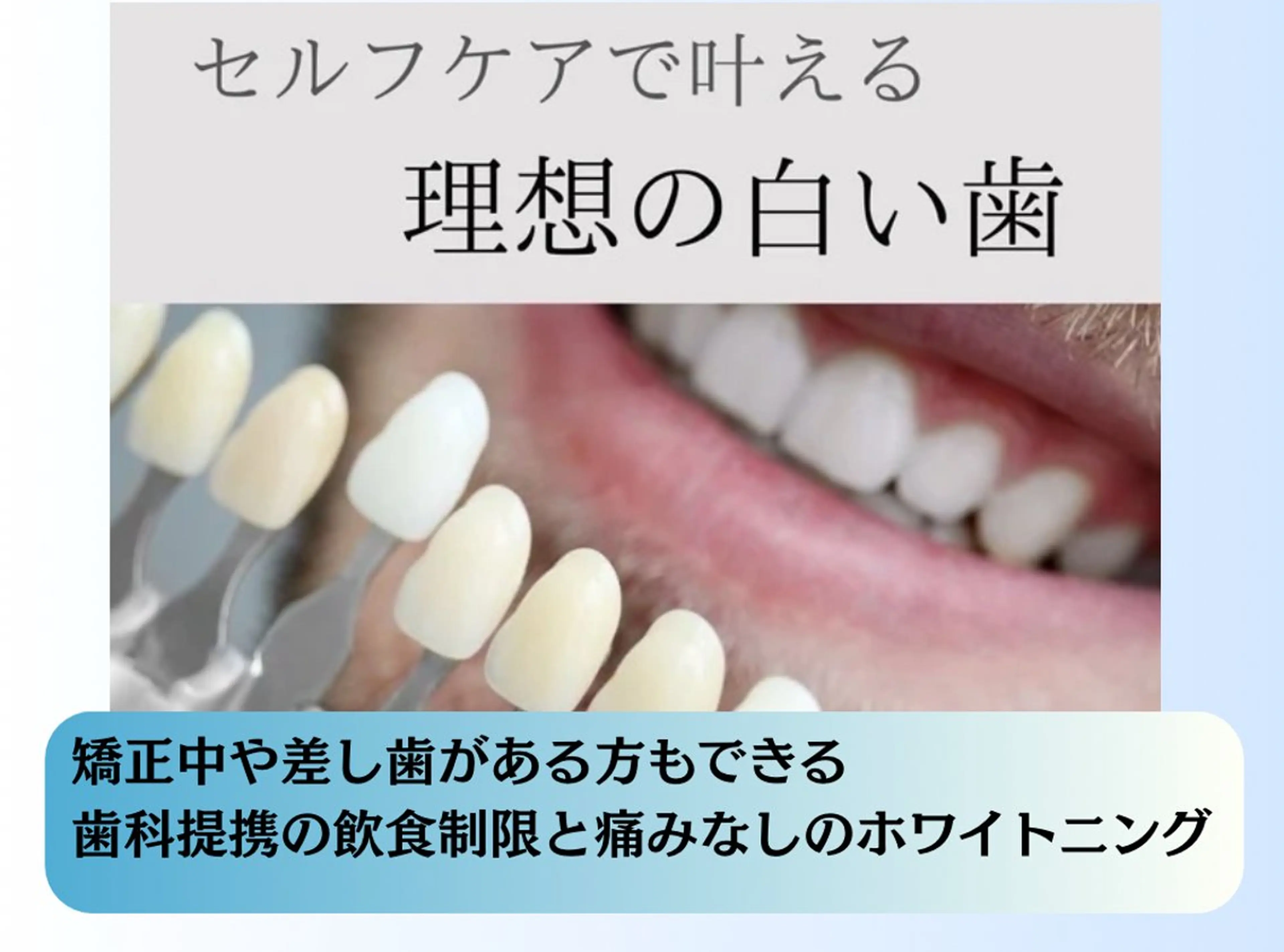 ホワイトニングショップ静岡葵区店所属・ホワイトニング ショップ葵区静岡駅店のその他イメージ