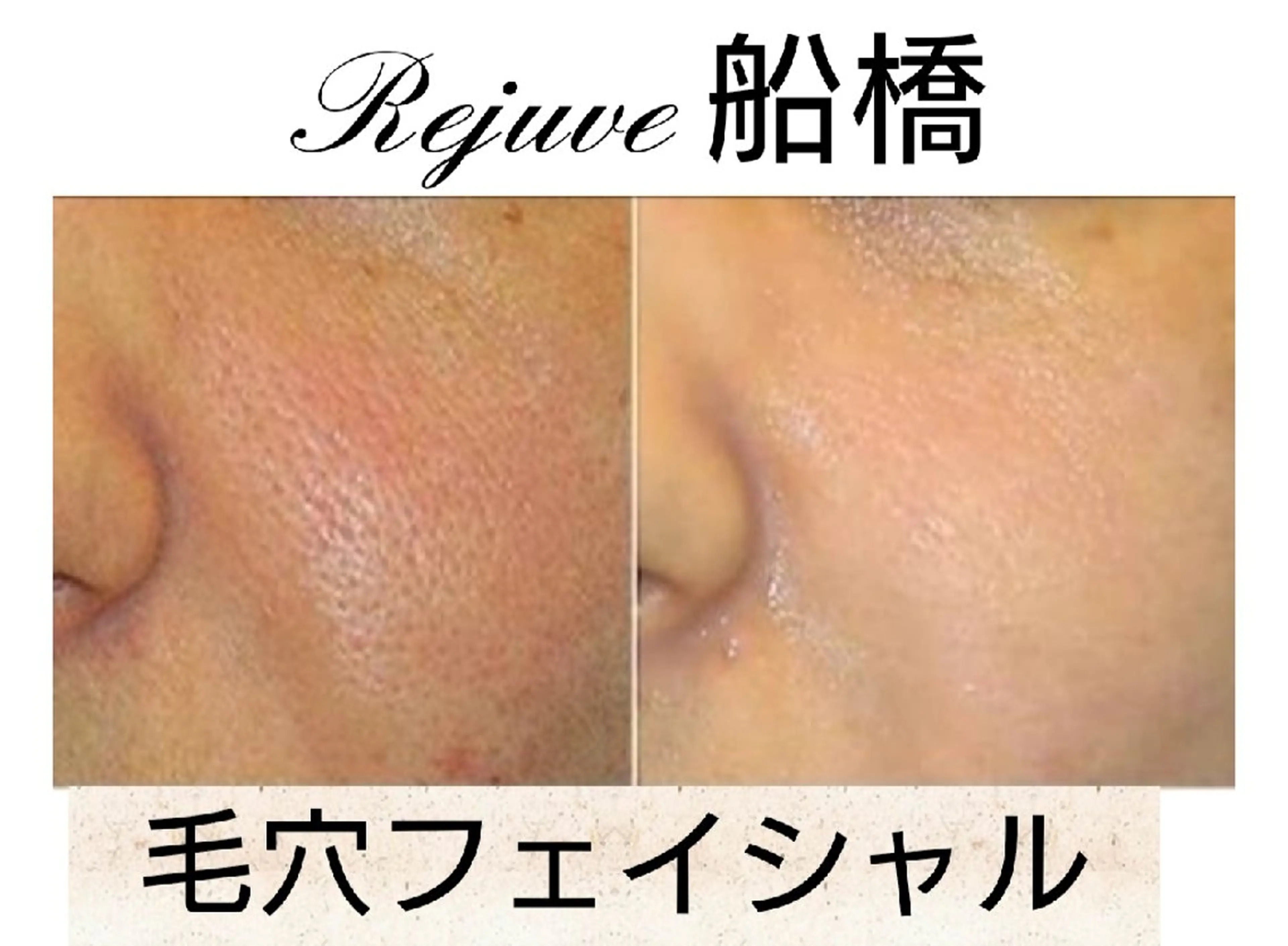 エステ M✨ Hoshi💎✨のエステ・リラクイメージ