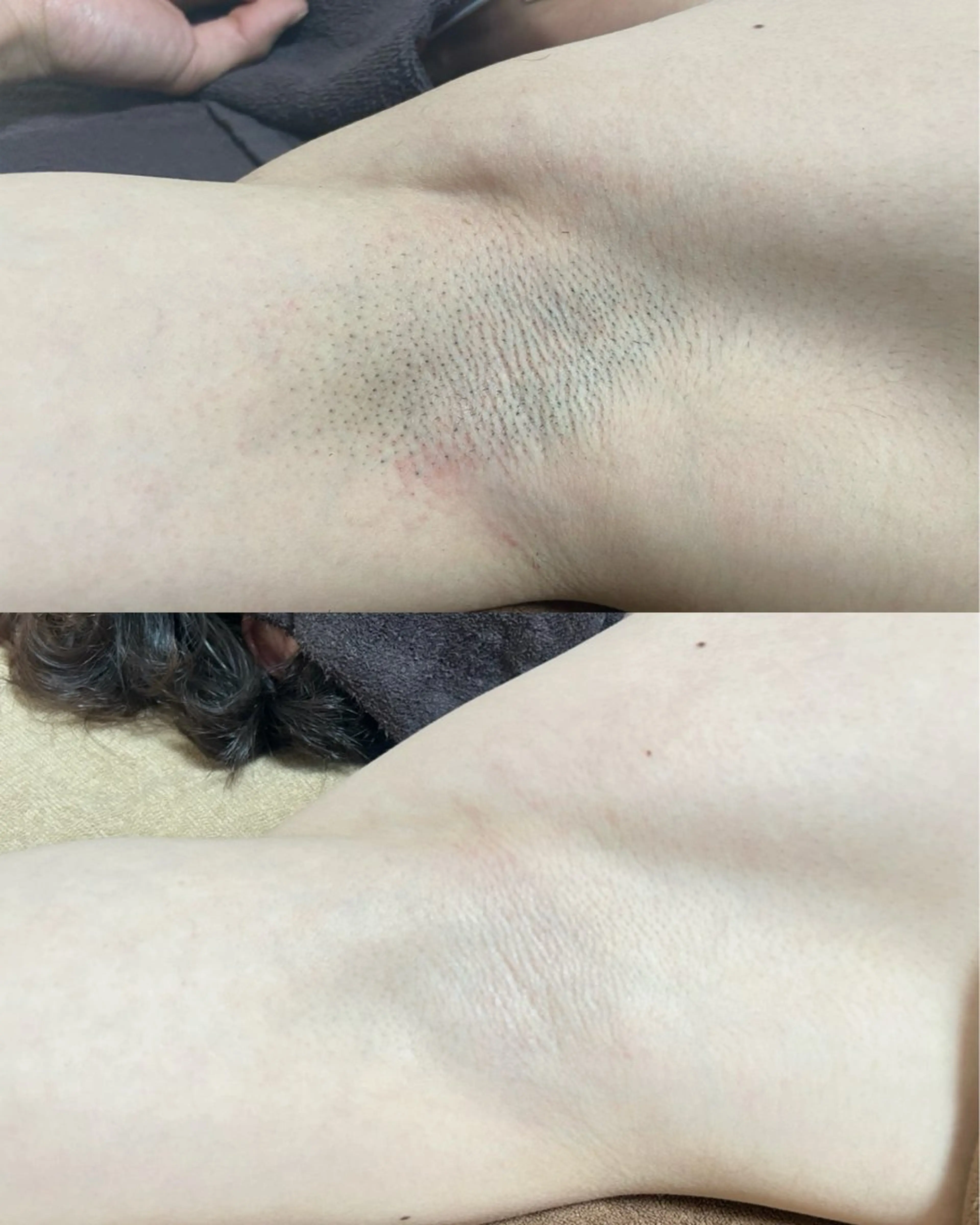 脱毛 Be Charm 山﨑のエステ・リラクイメージ