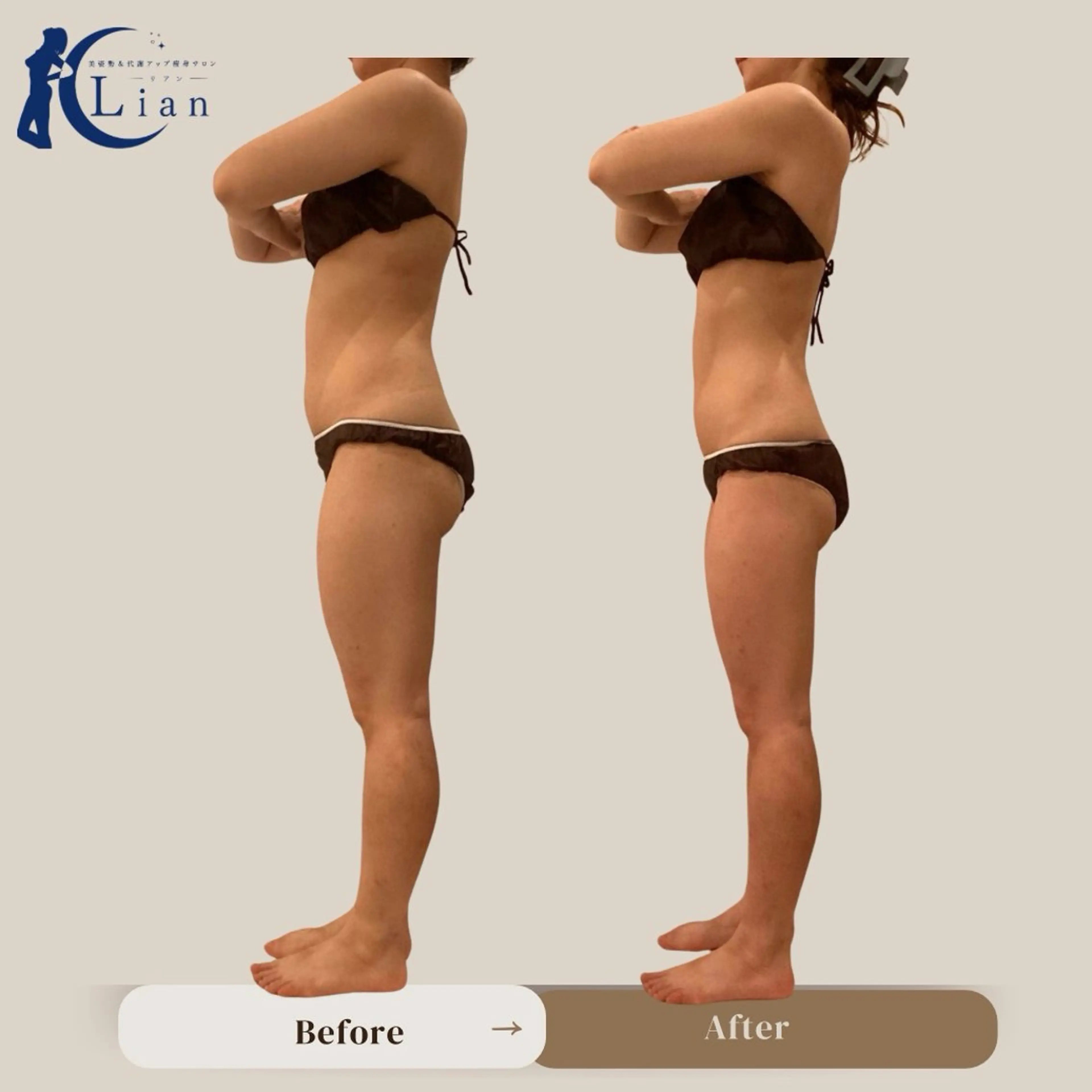 【太さ/たるみのある二の腕が気になる方】部位集中★二の腕メニュー⭐️の写真