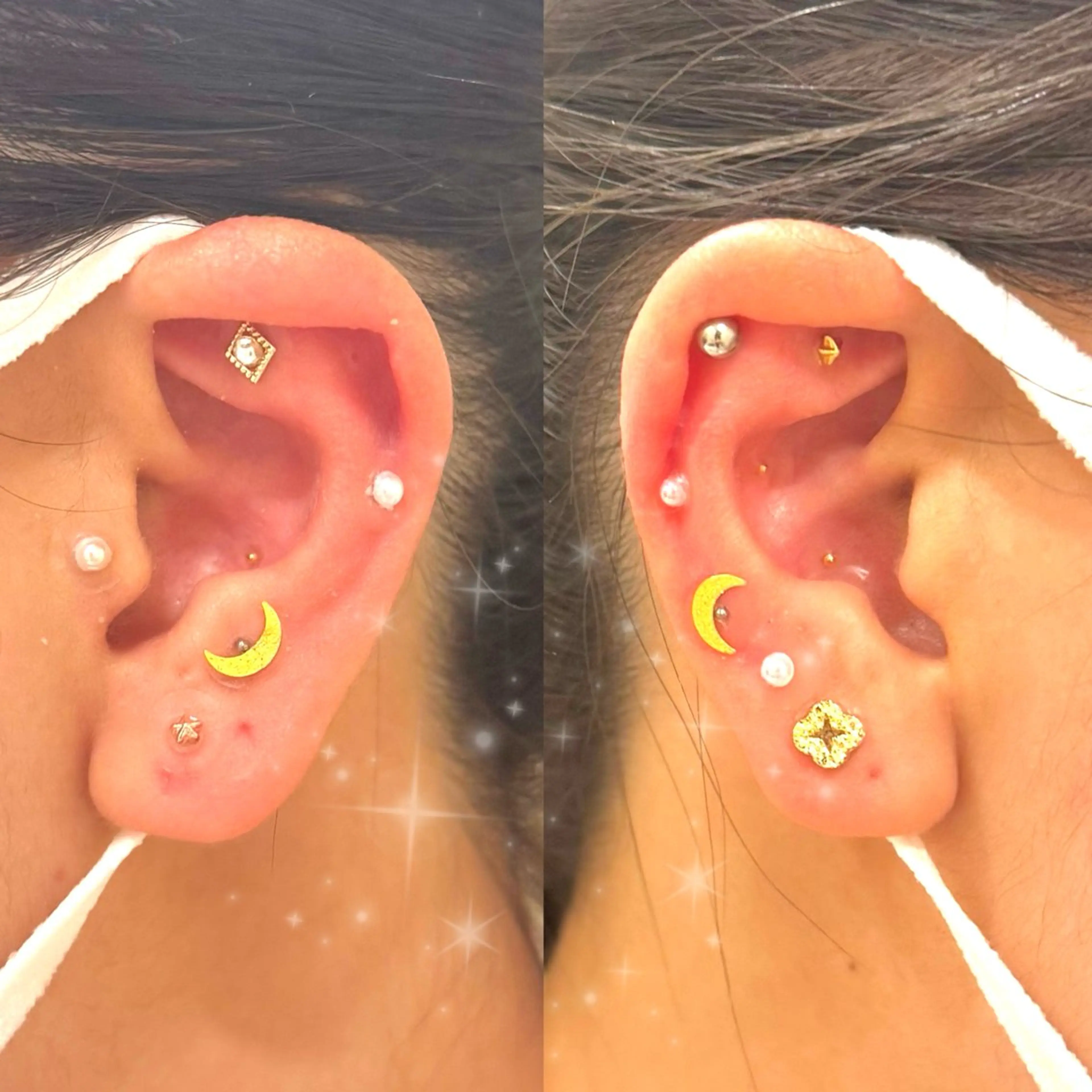 エステ リラク Ayaka🤍 恵比寿/美容鍼/整体のエステ・リラクイメージ