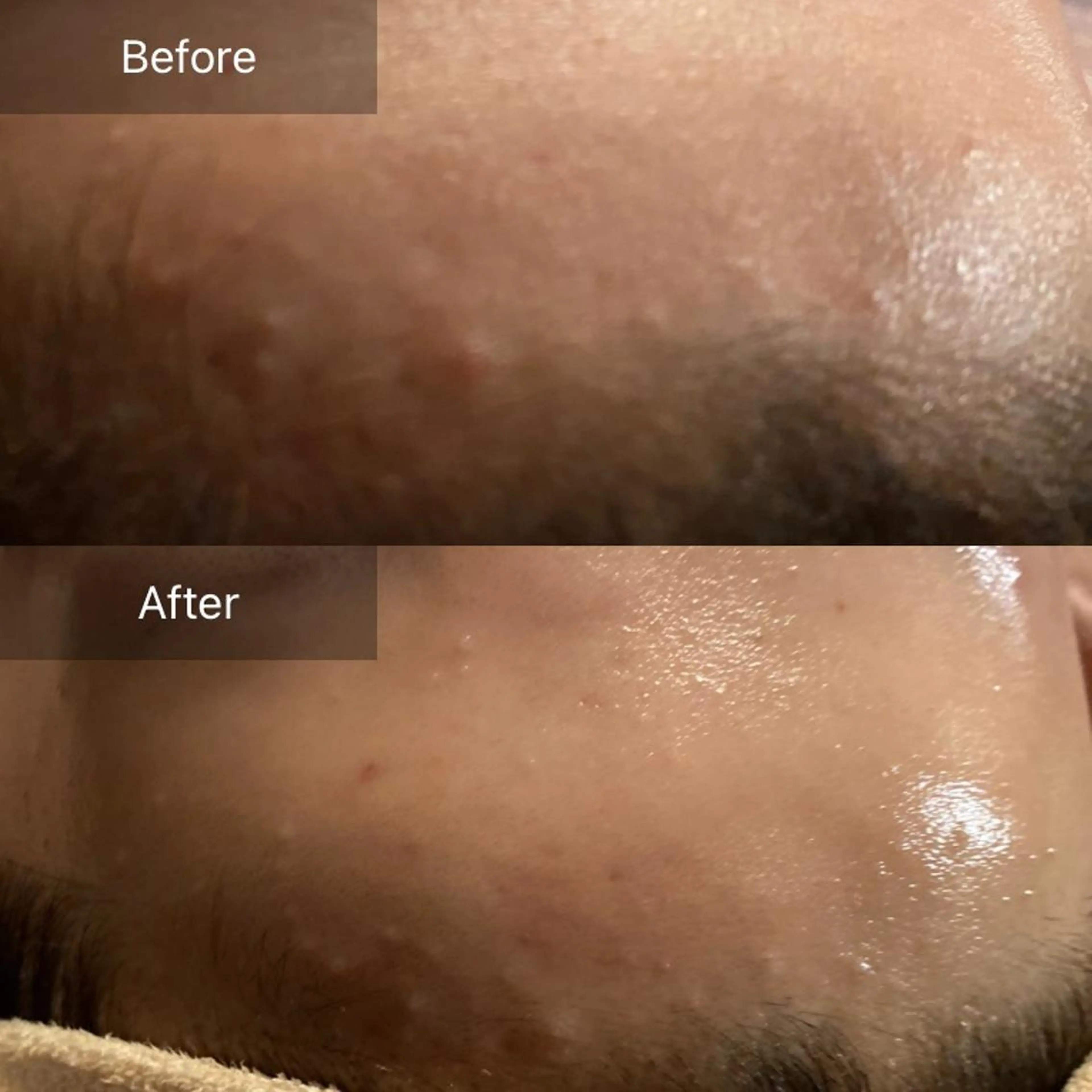 毛穴から始める肌メン テマンダリンオレンジのエステ・リラクイメージ