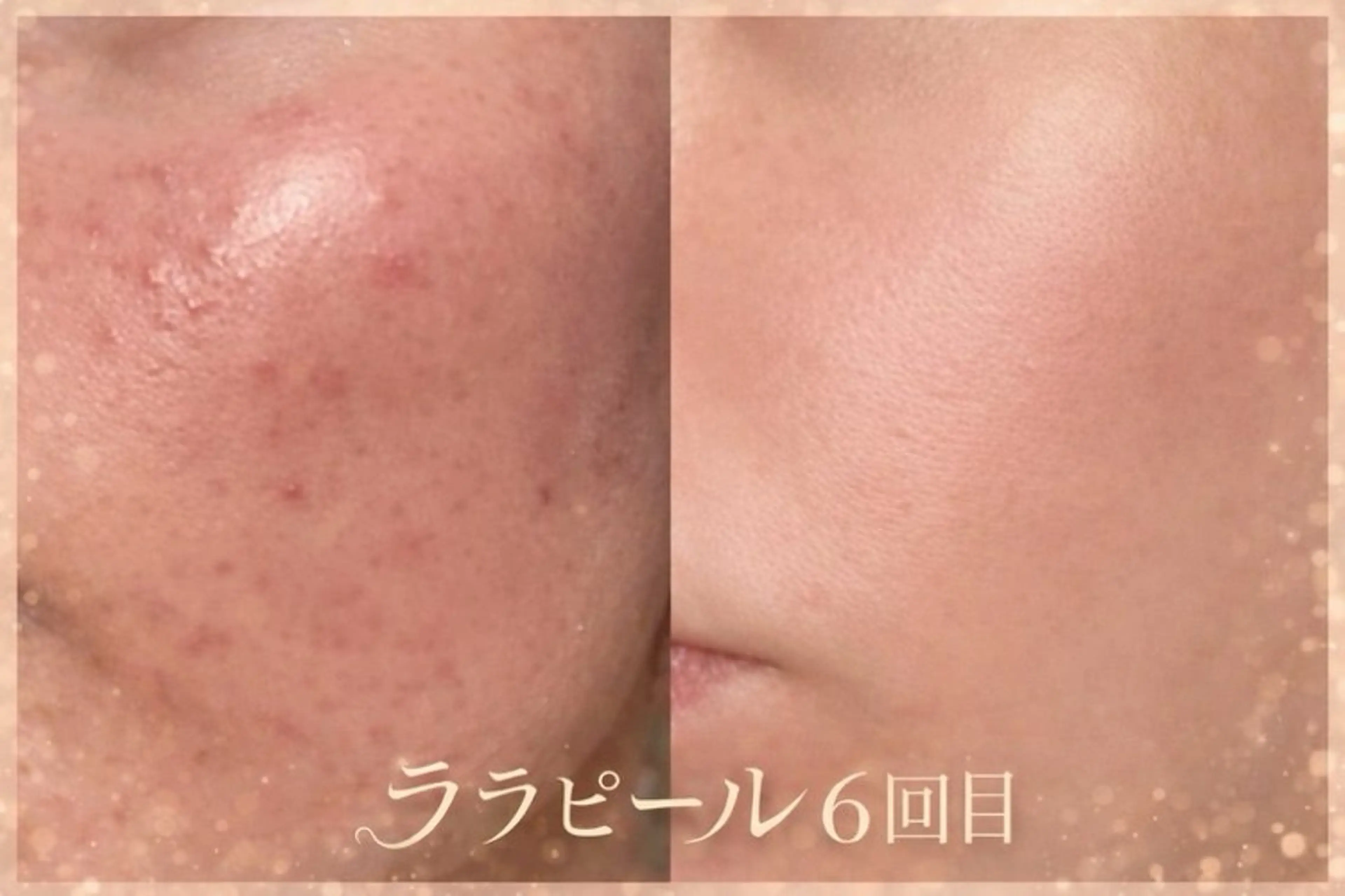 BIJOU八井 美加のエステ・リラクイメージ