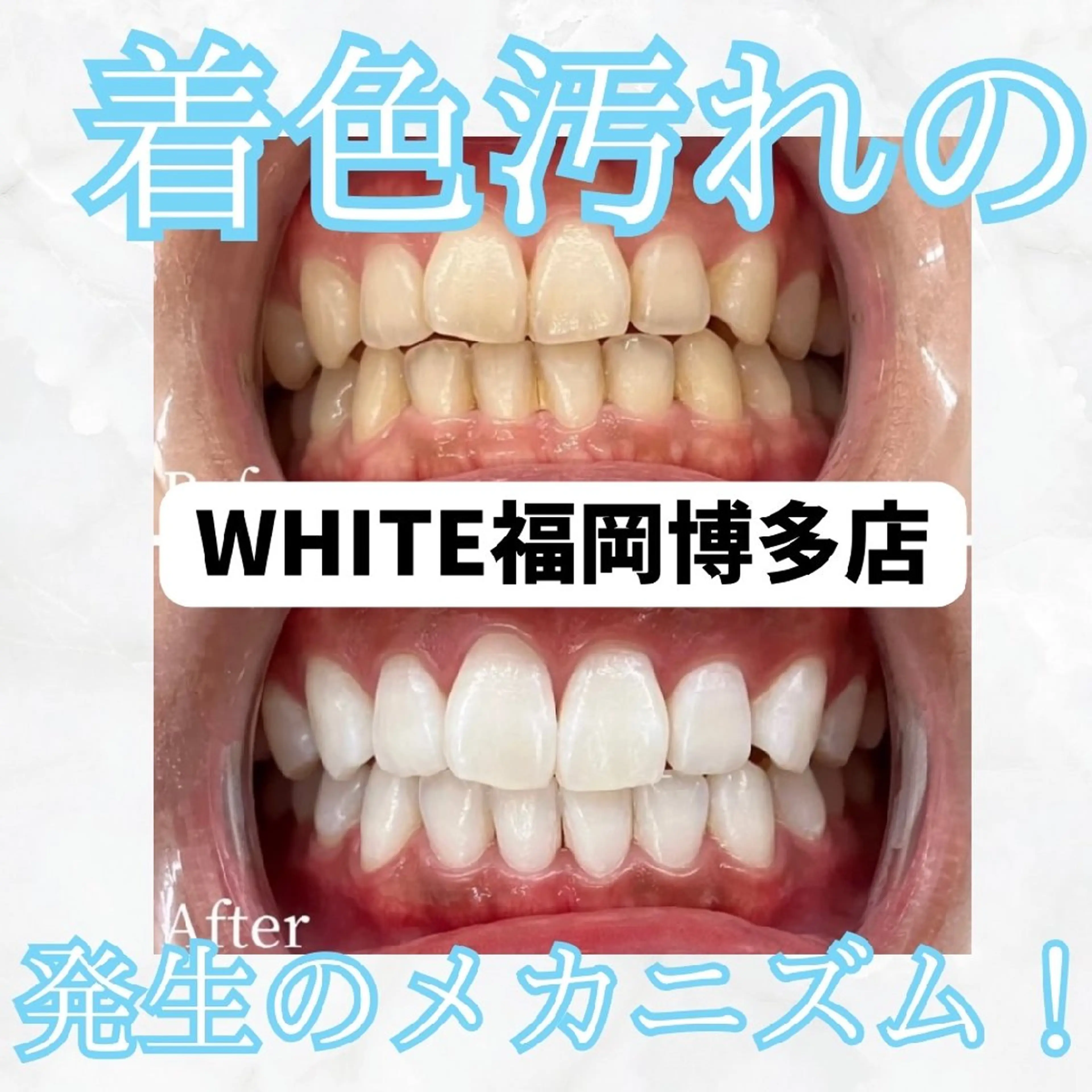 メンズ その他 セルフホワイトニング WHITE福岡博多店のエステ・リラクイメージ