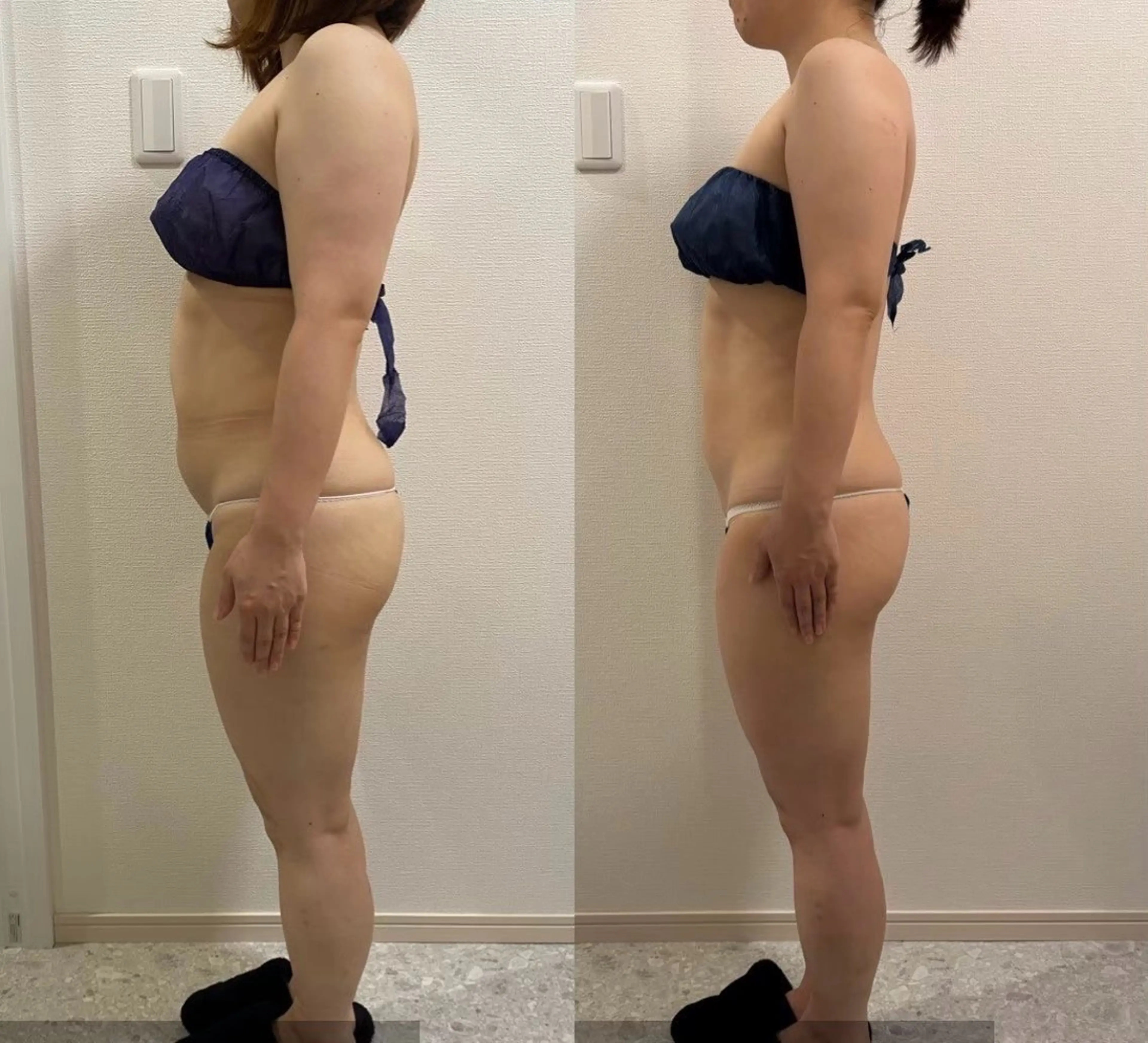 エステ 山口 夏生のエステ・リラクイメージ