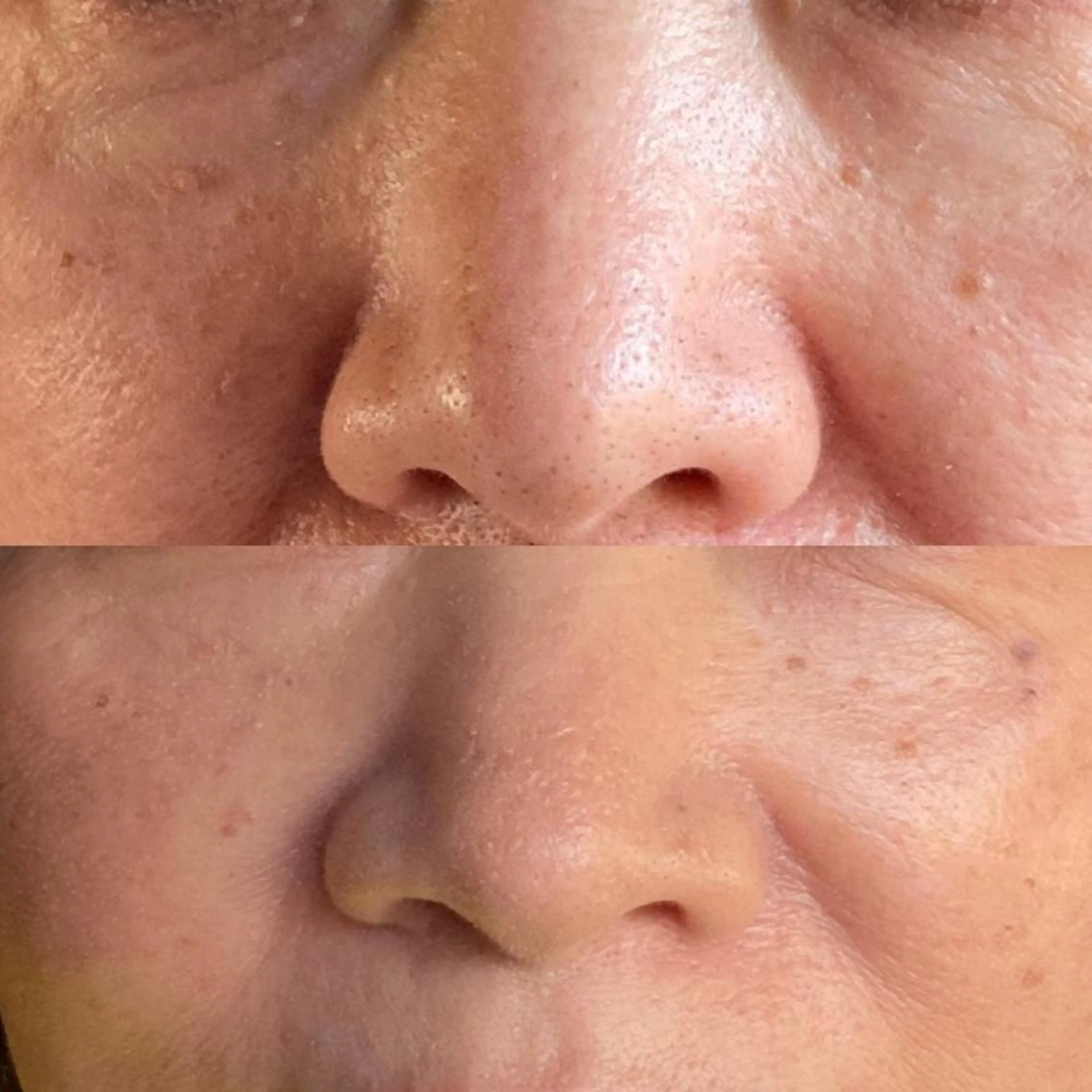 脱毛 産毛専門店 Bittoのエステ・リラクイメージ