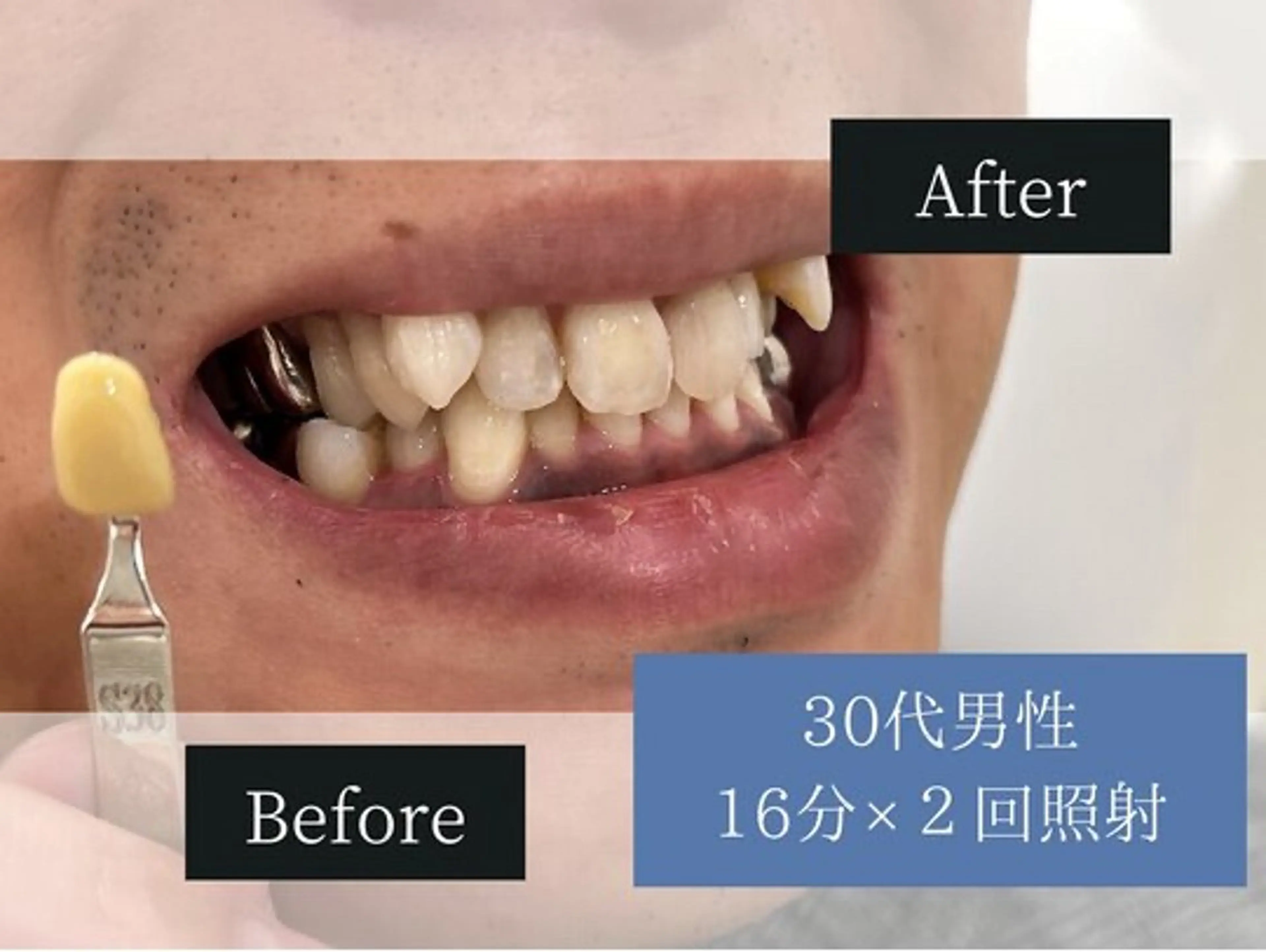 ホワイトニングカフェ 荻窪店のその他イメージ