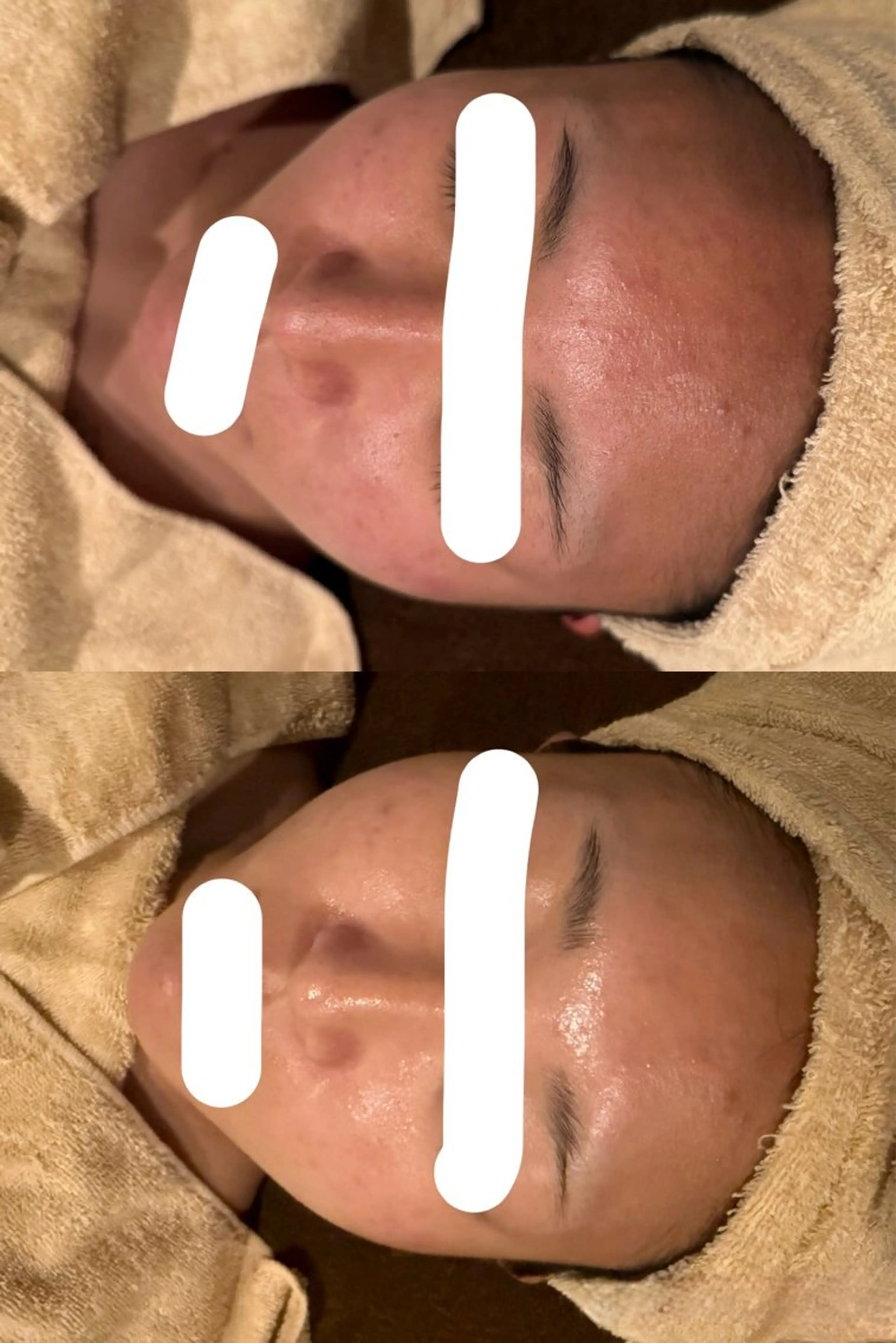 エステサロンPONO所属・PONO 天王寺/エステのエステ・リラクイメージ