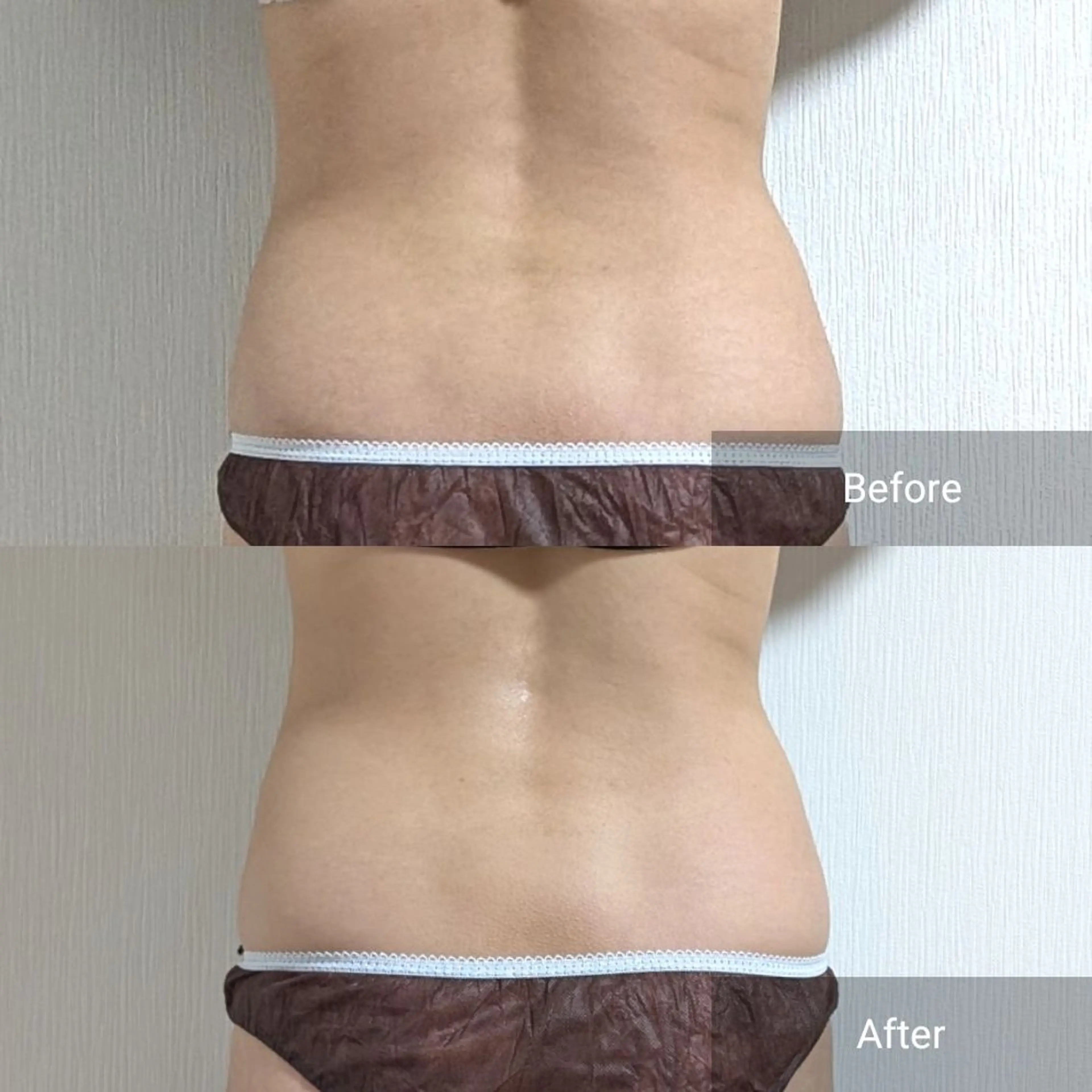 エステ nail RiRi アトレナチュラのエステ・リラクイメージ