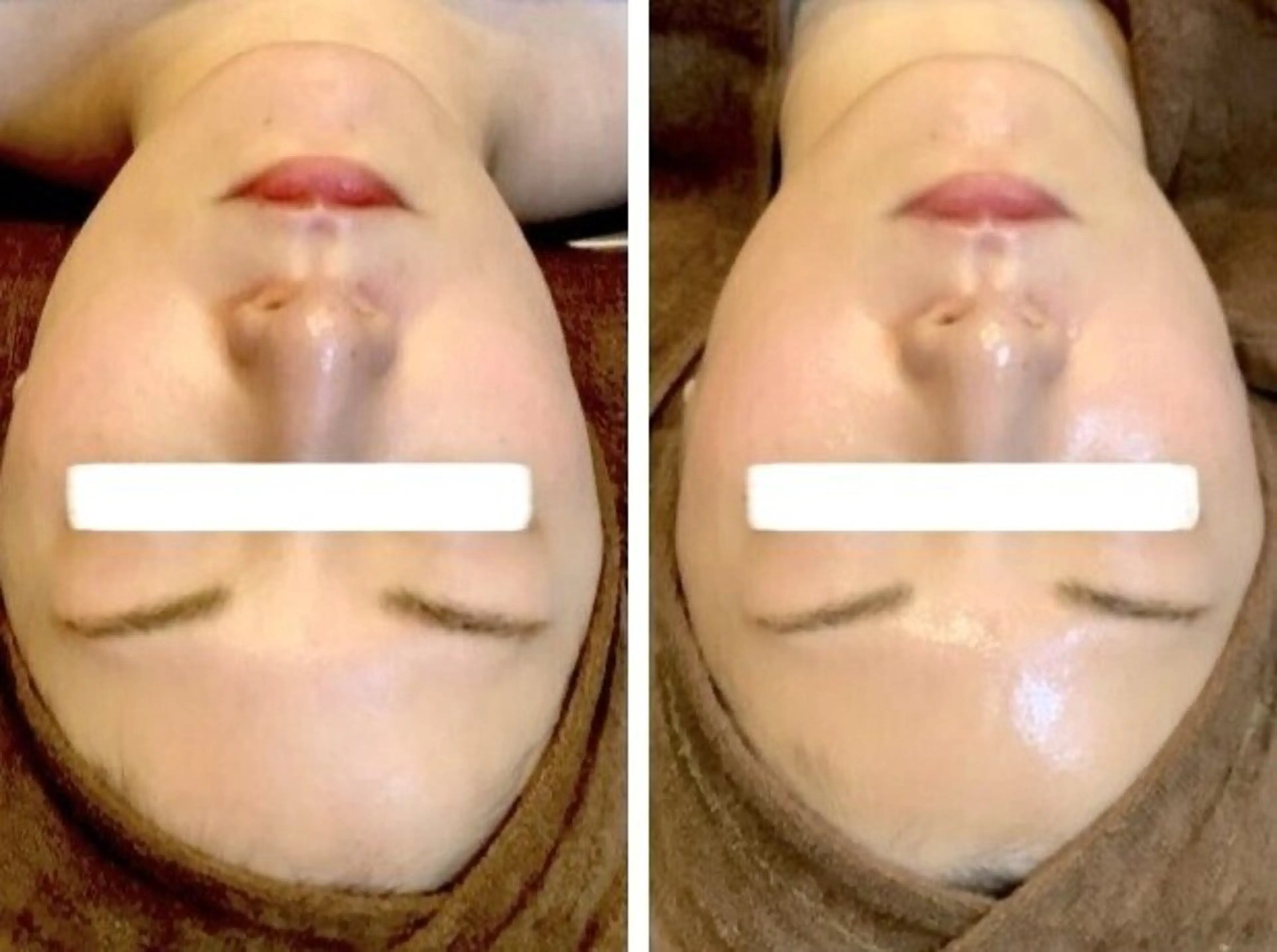 ミニモ学割🧑🎓【乾燥悩みの方】 お肌表面の汚れをしっかり落としてデイープ保湿 ⚠️学生証など確認書類 要⚠️の写真