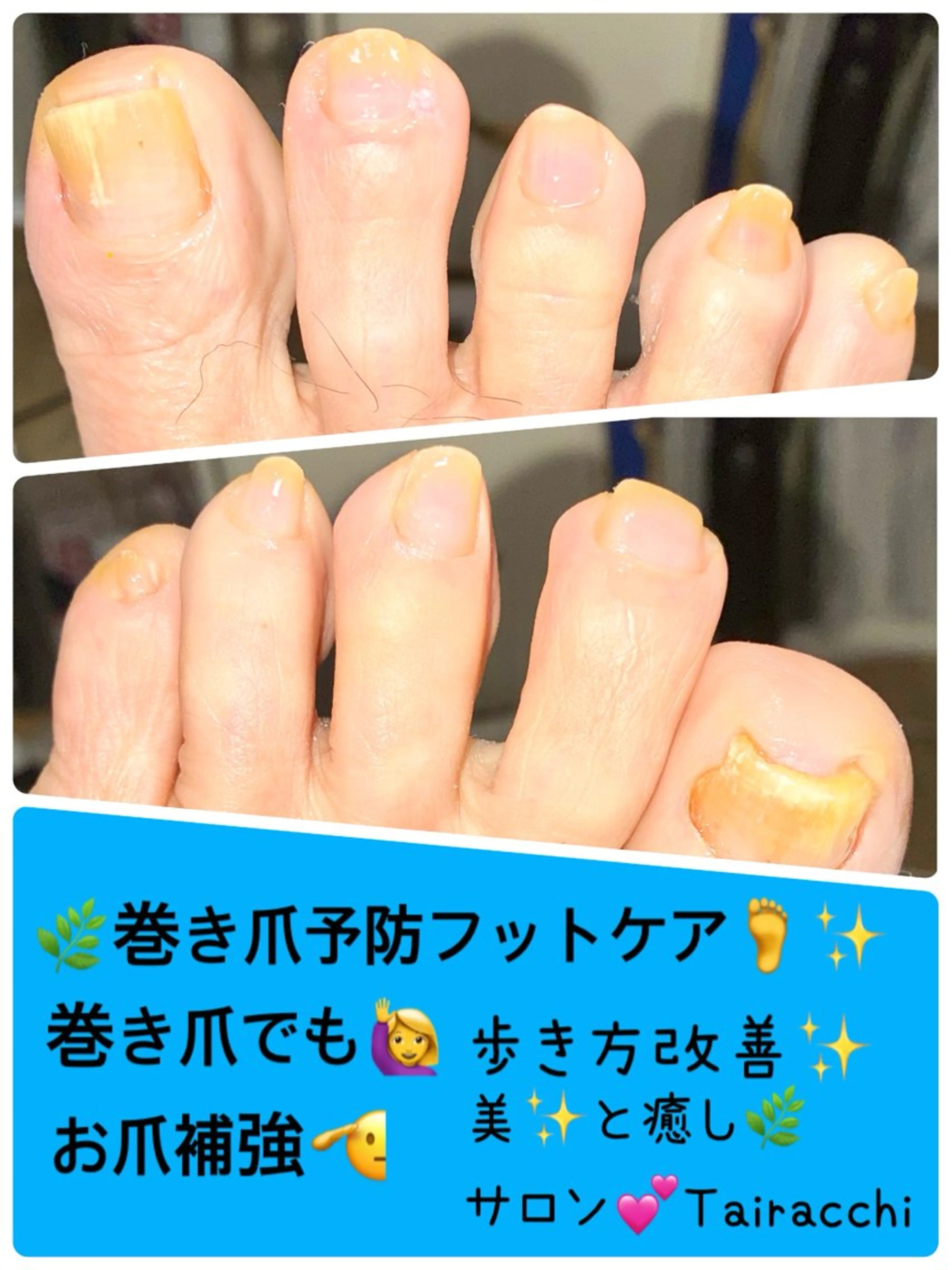 ネイル フットネイル フットネイル Tairacchi ﾀｲﾗｯﾁのエステ・リラクイメージ