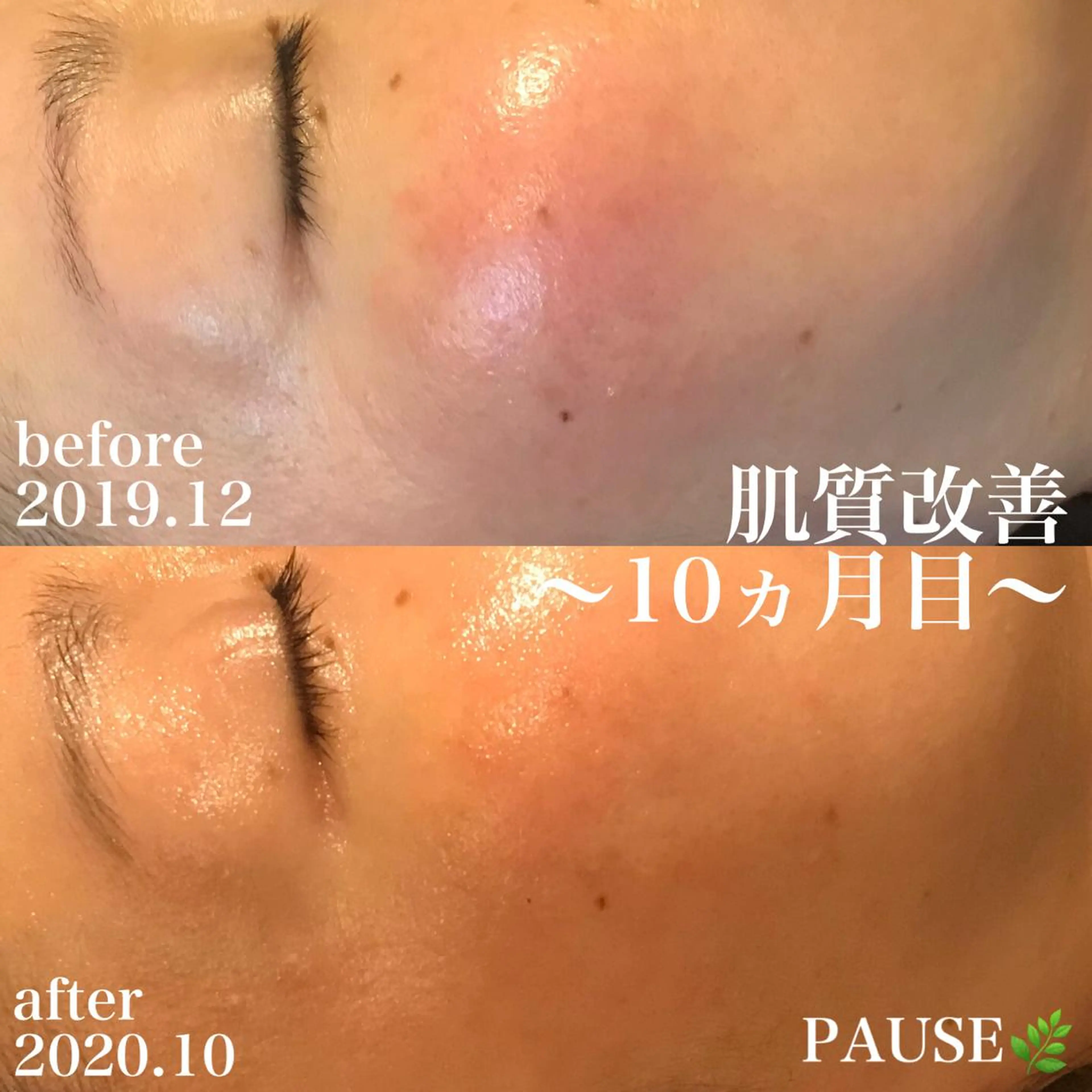 エステ リラク 浜野 恵美のエステ・リラクイメージ