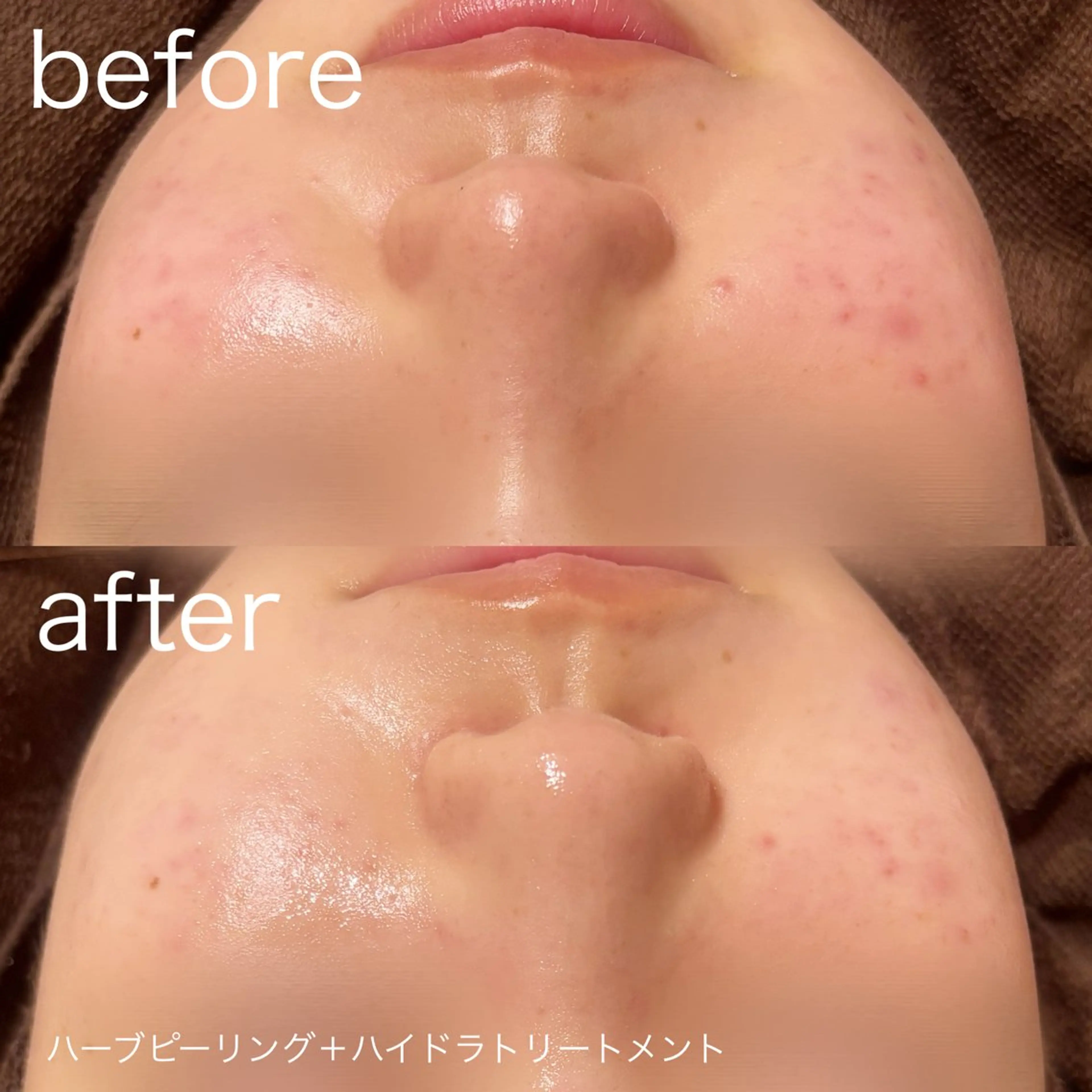 脱毛 lulularico Yuのエステ・リラクイメージ