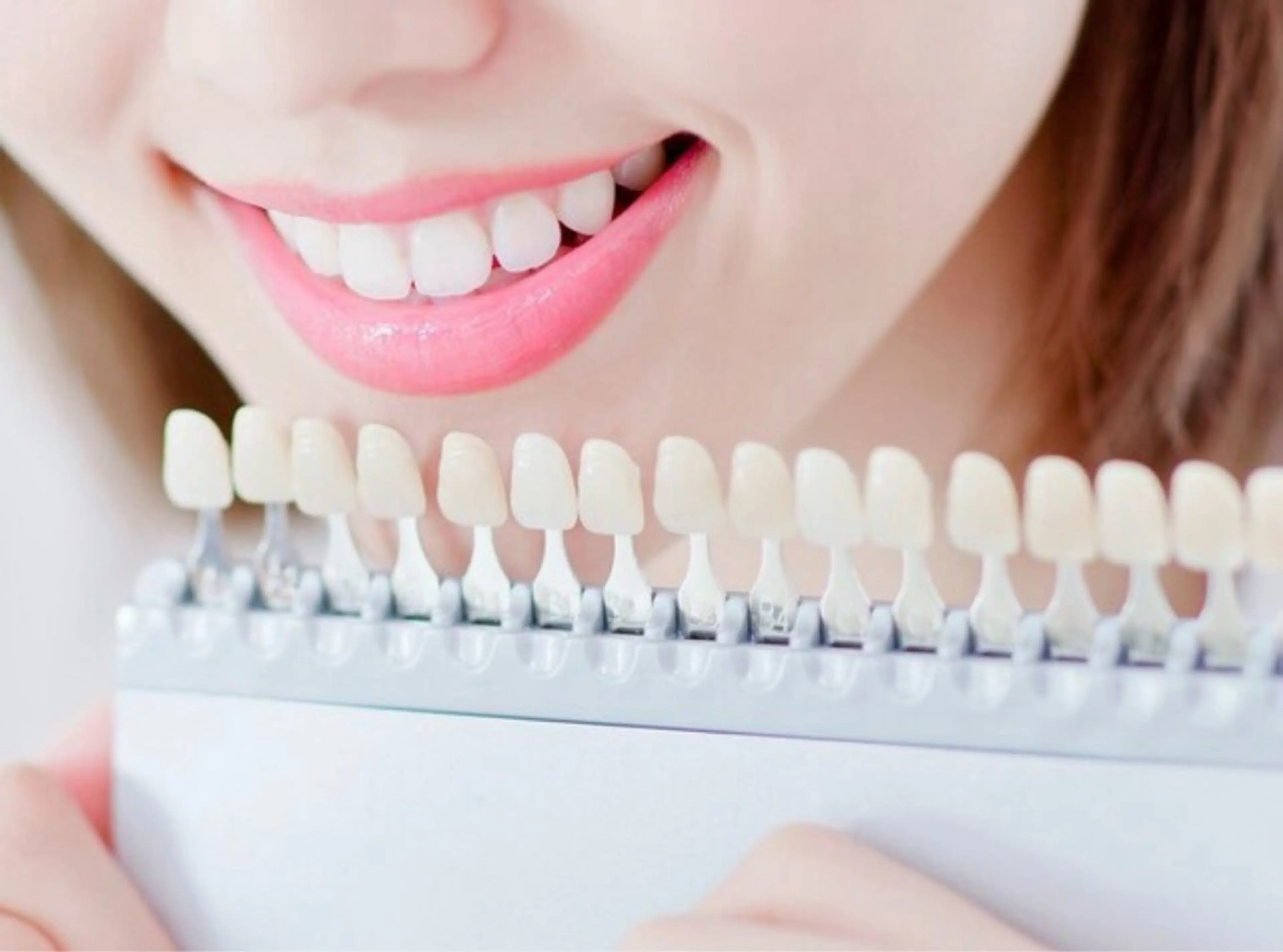 【平日限定16時迄】セルフホワイトニングで白い歯(9分2セット)1回別料金なしの写真