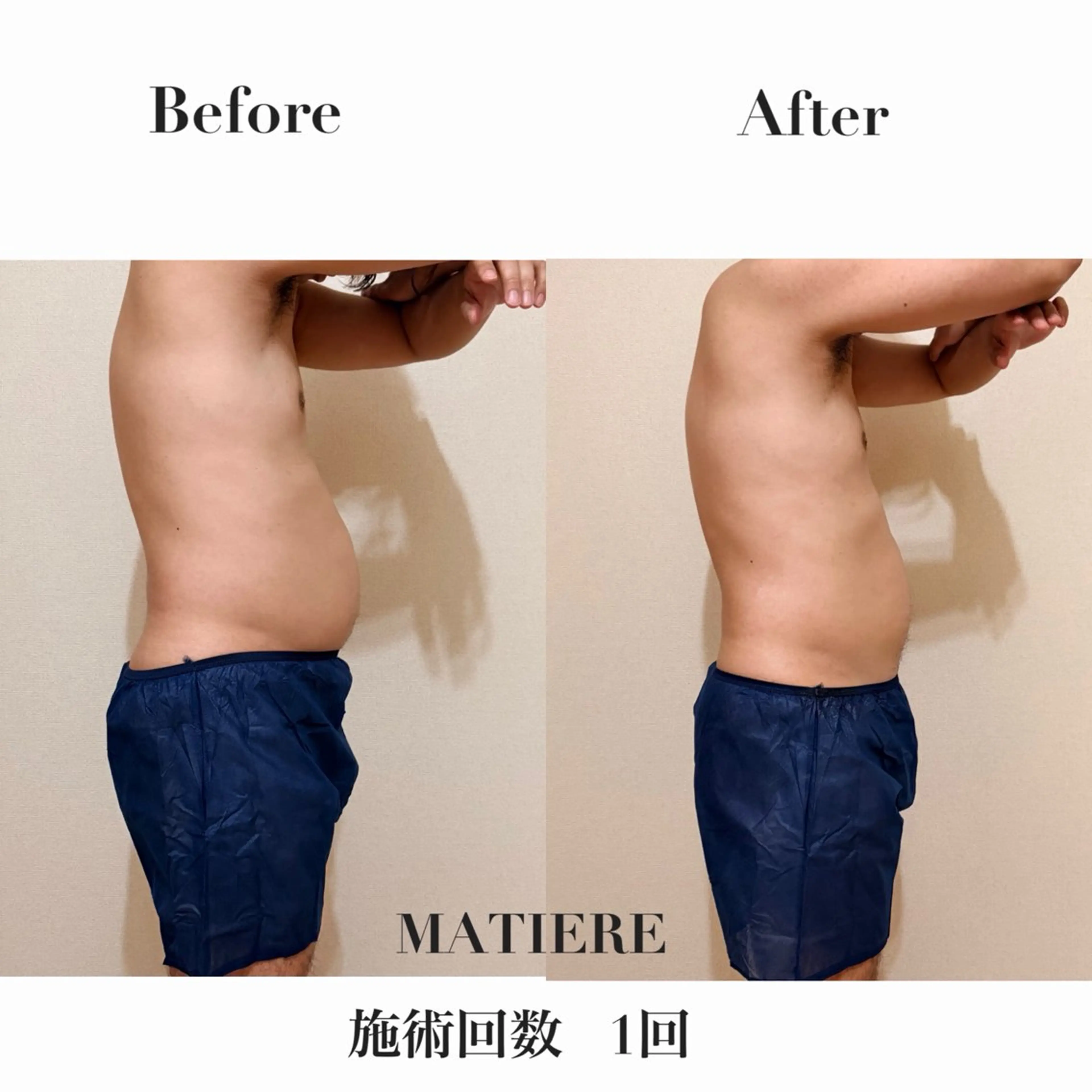 エステ MATIÈRE マティエールのエステ・リラクイメージ