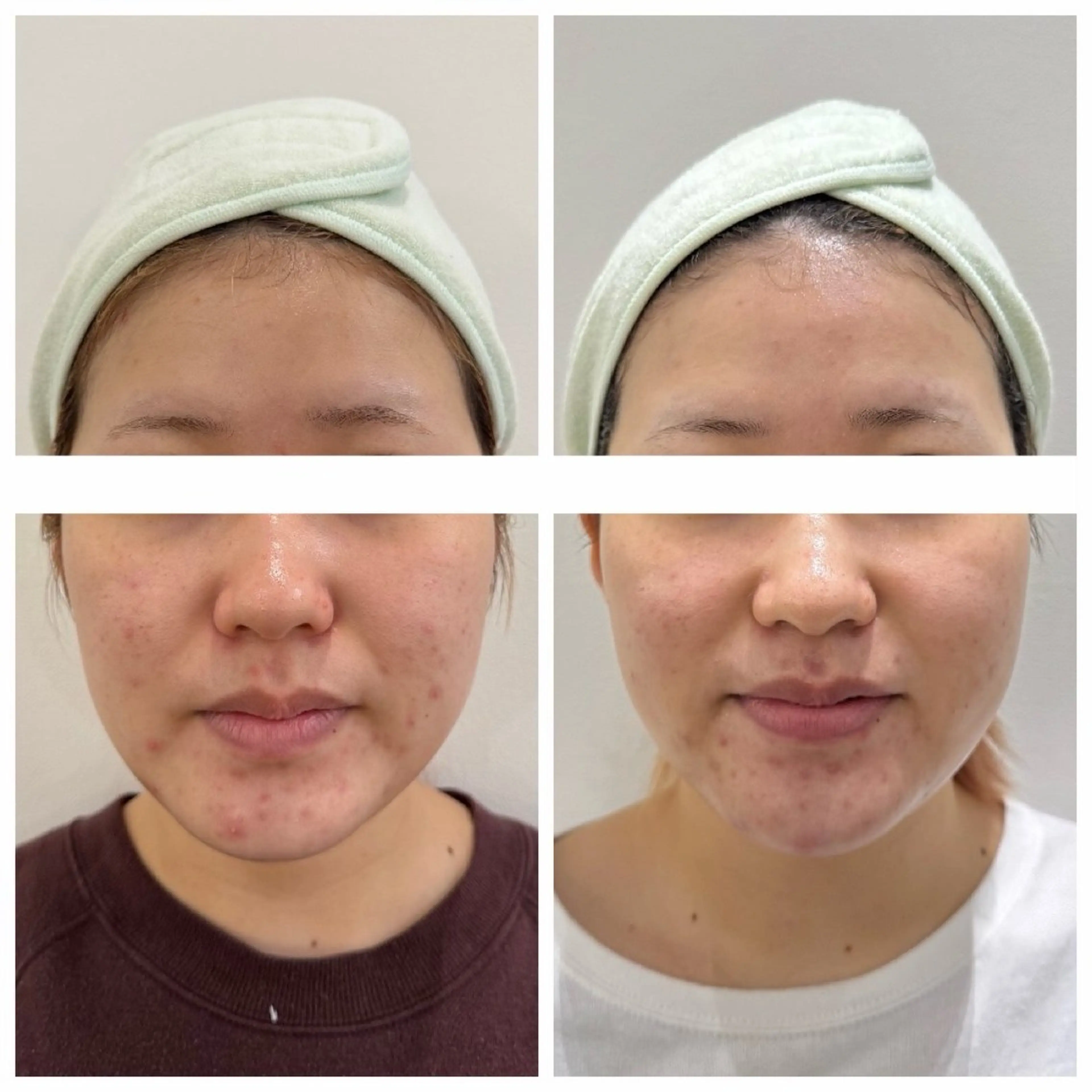 エステ 松岡 愛会里のエステ・リラクイメージ