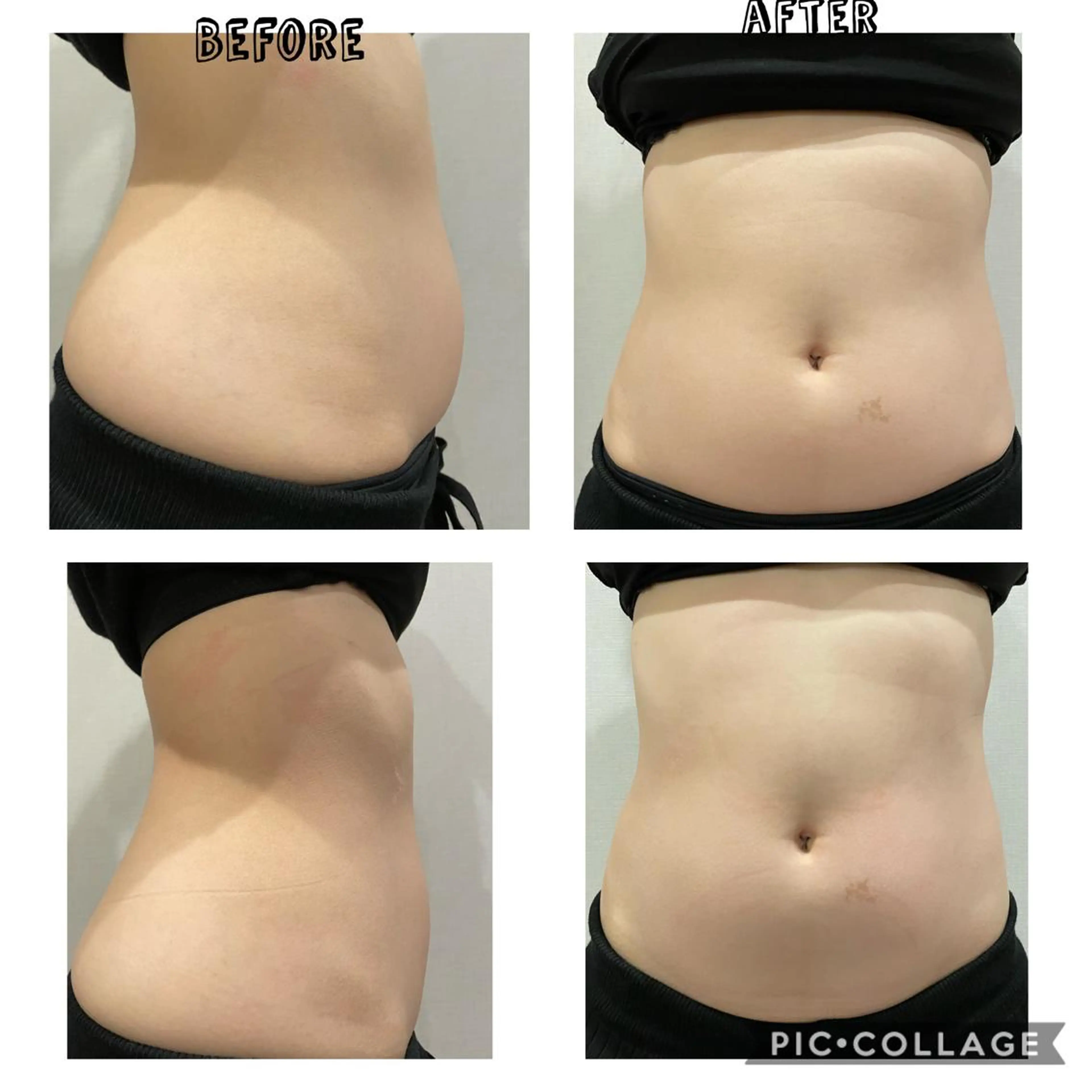 その他 POLA大阪堀江店所属・POLA大阪堀江店 小顔エステのエステ・リラクイメージ