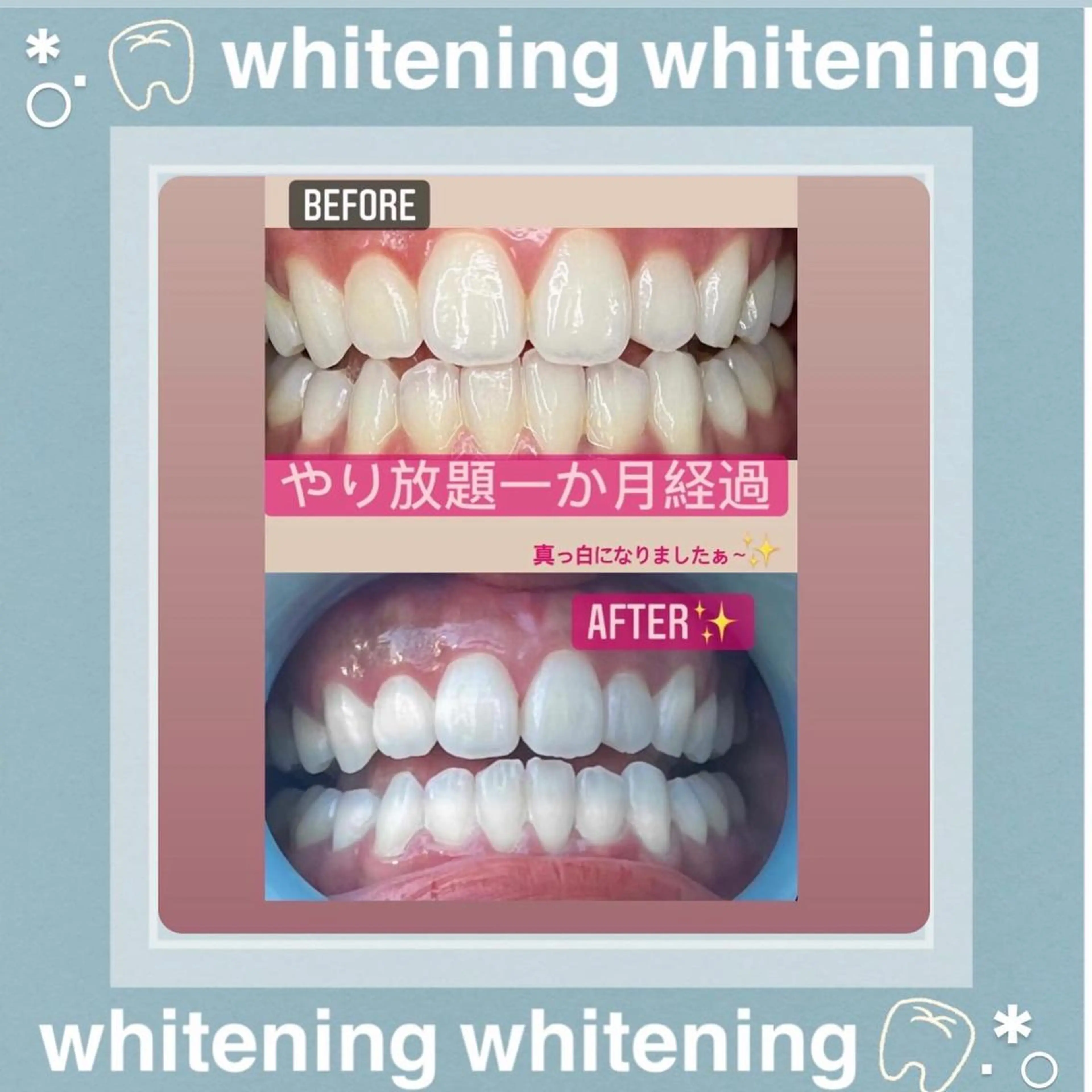 その他 LAVISH nail salonのヘアスタイル