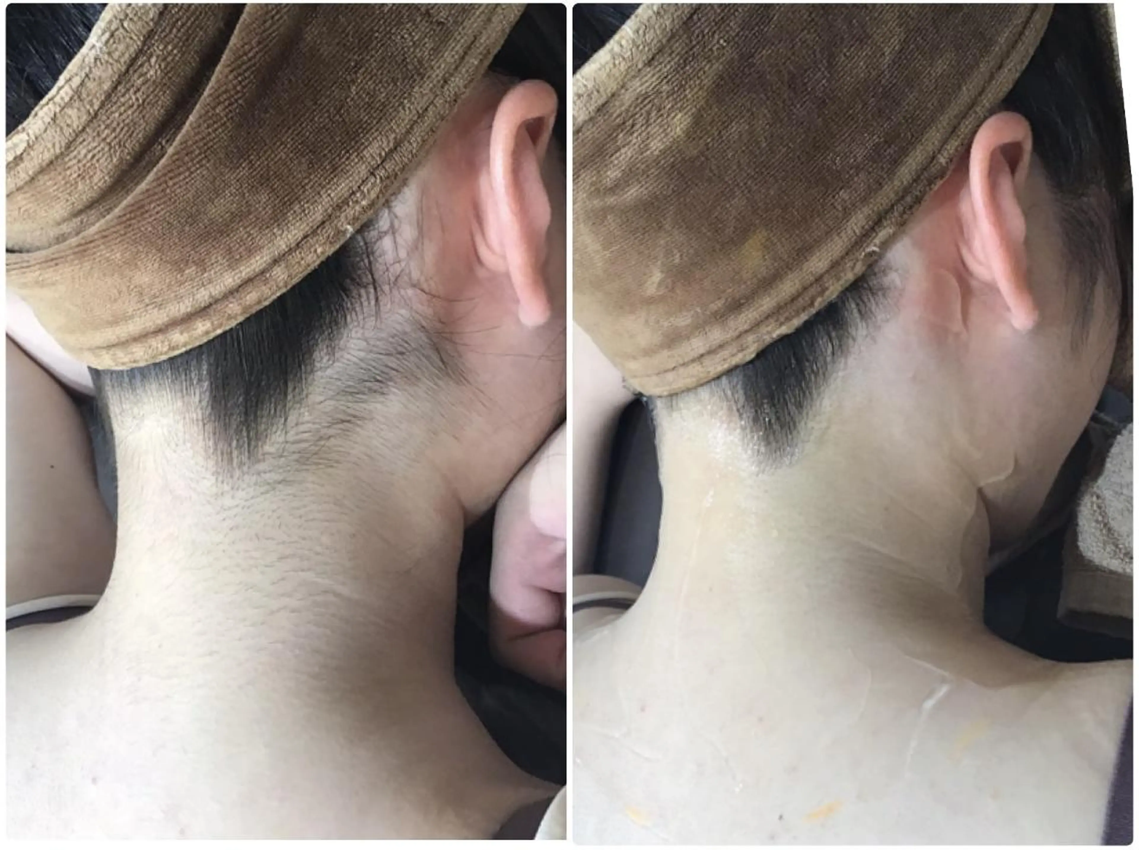 脱毛 🤍Linola🤍 レイビス　須藤のエステ・リラクイメージ