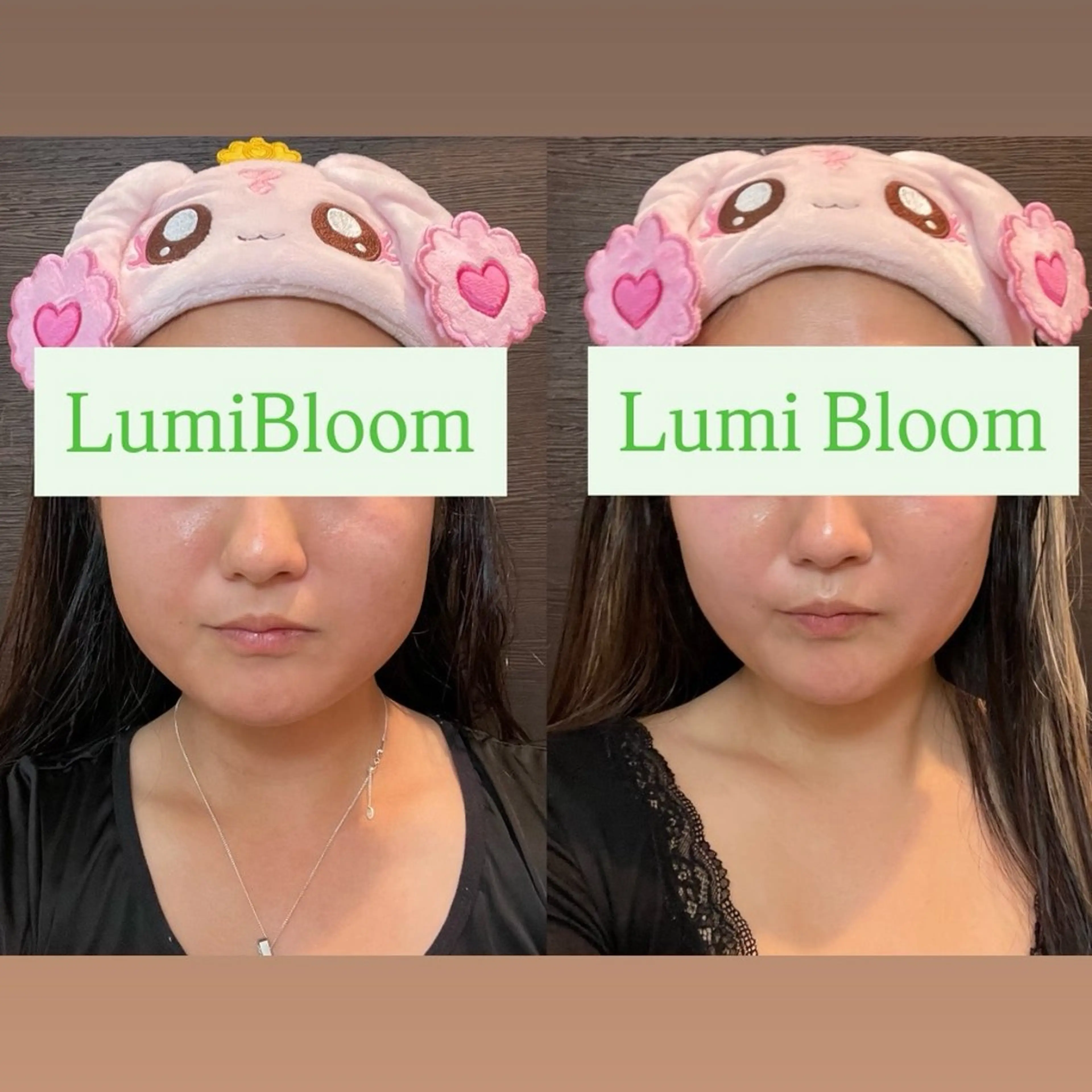 💎ご褒美フルケアコース💎【よもぎ蒸し+リンパ流し美肌ケア+頭皮ヘッドケア】の写真