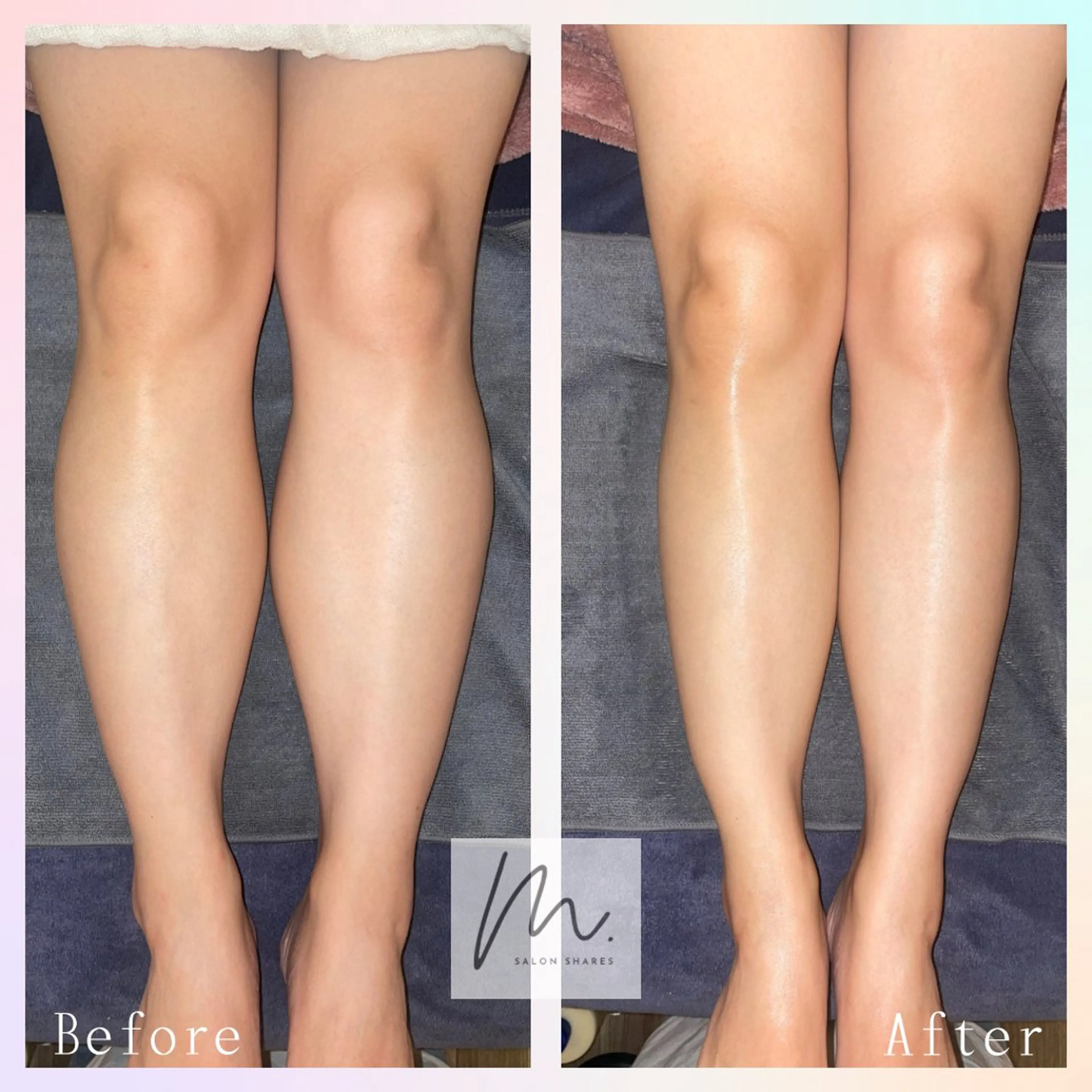 エステ リラク SHARES MADOKAのエステ・リラクイメージ