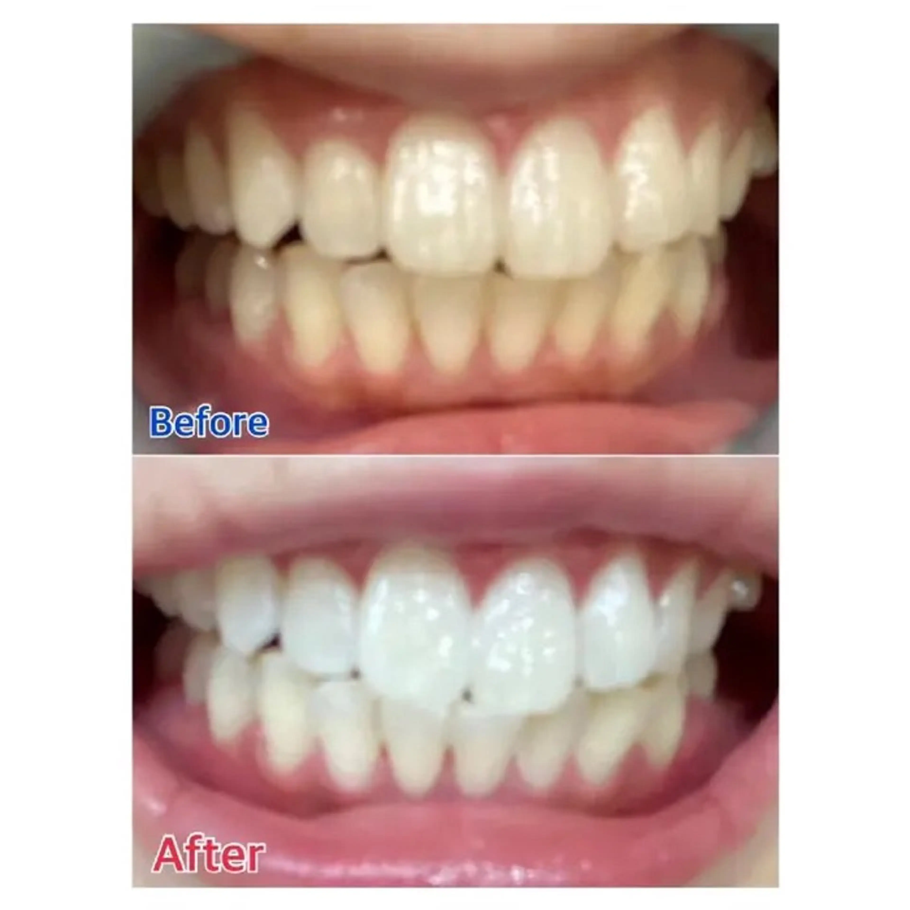 Ｍ渋谷 ホワイトニングのエステ・リラクイメージ