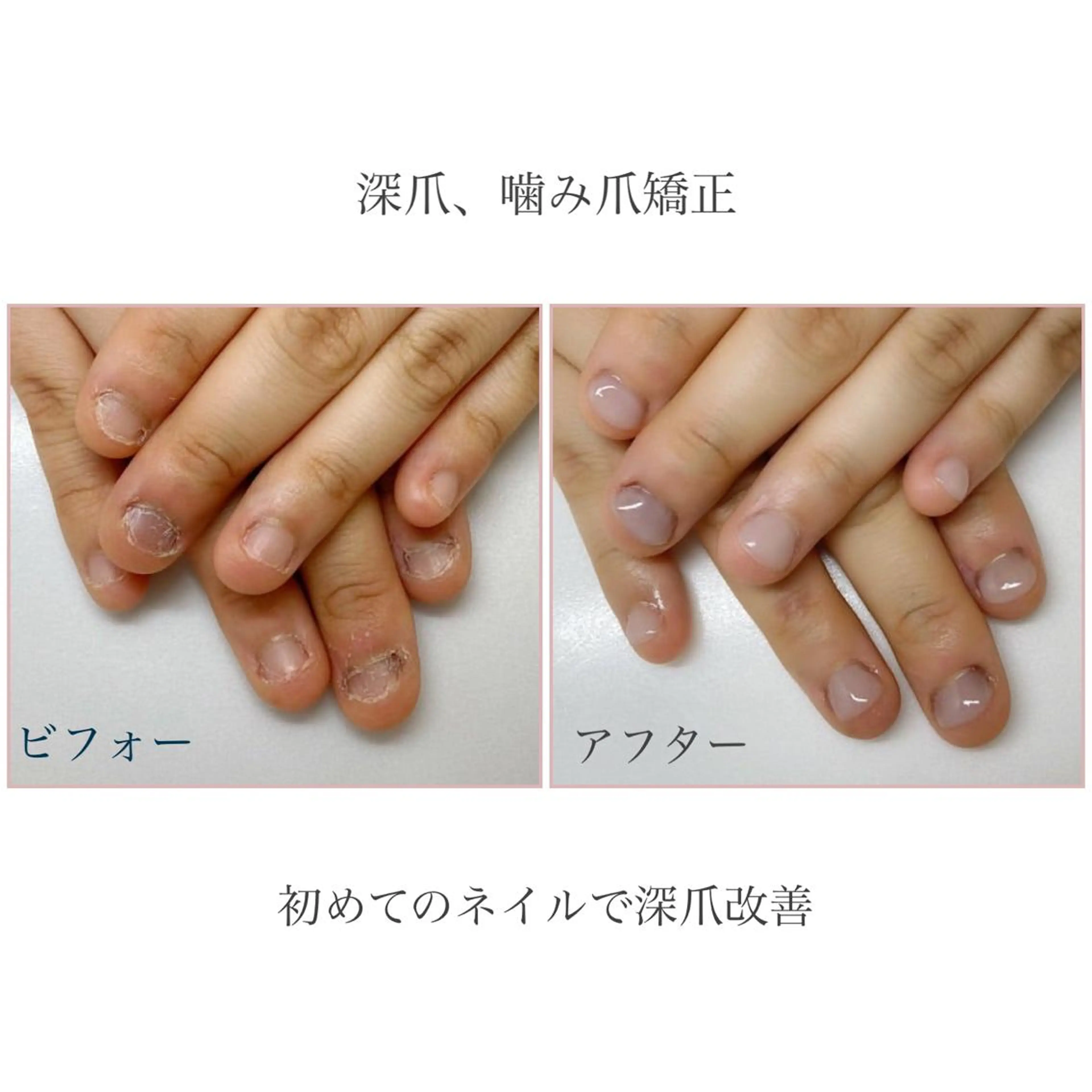 ネイル ネイルサロン アリュームのネイルデザイン