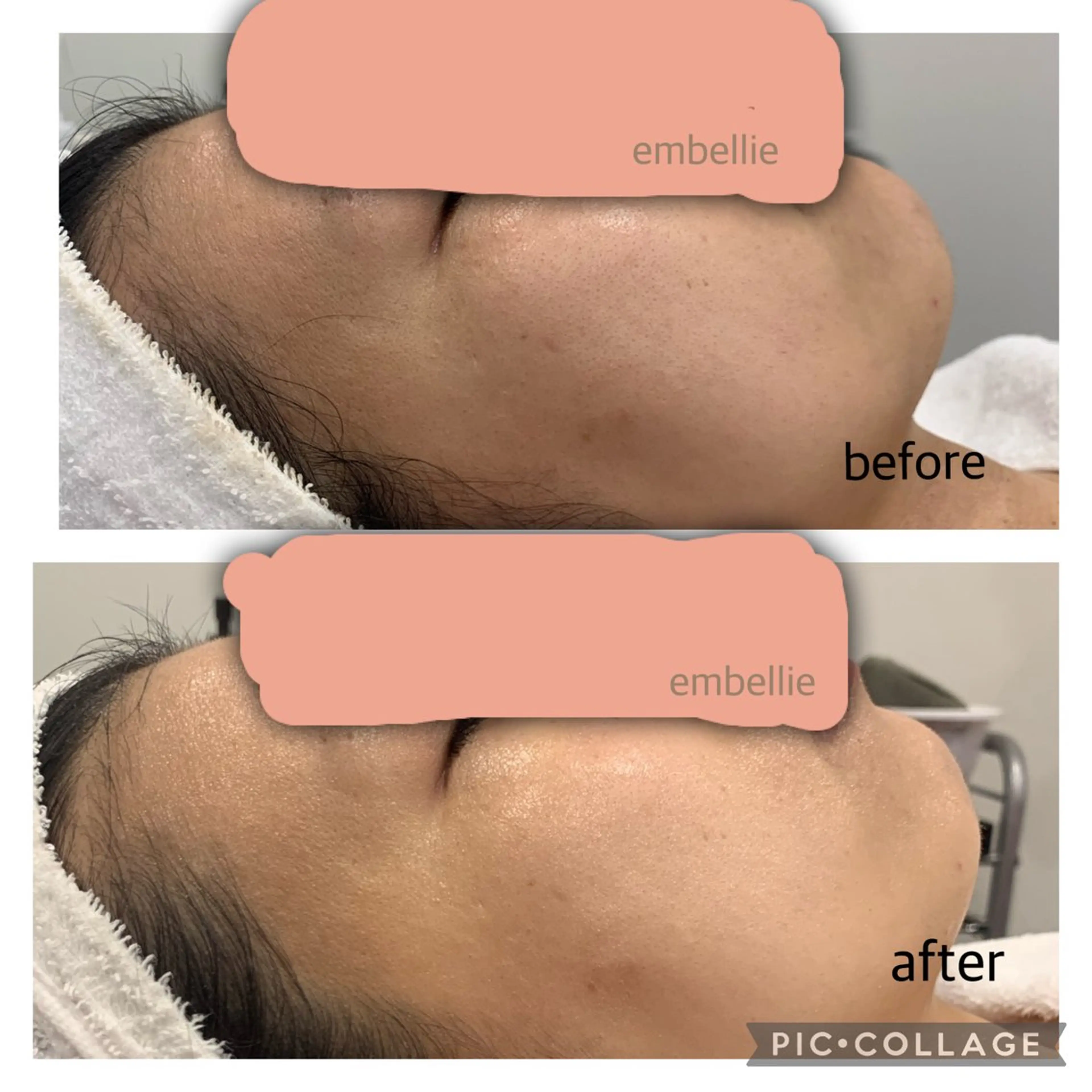 エステ miyasaka erikoのネイルデザイン