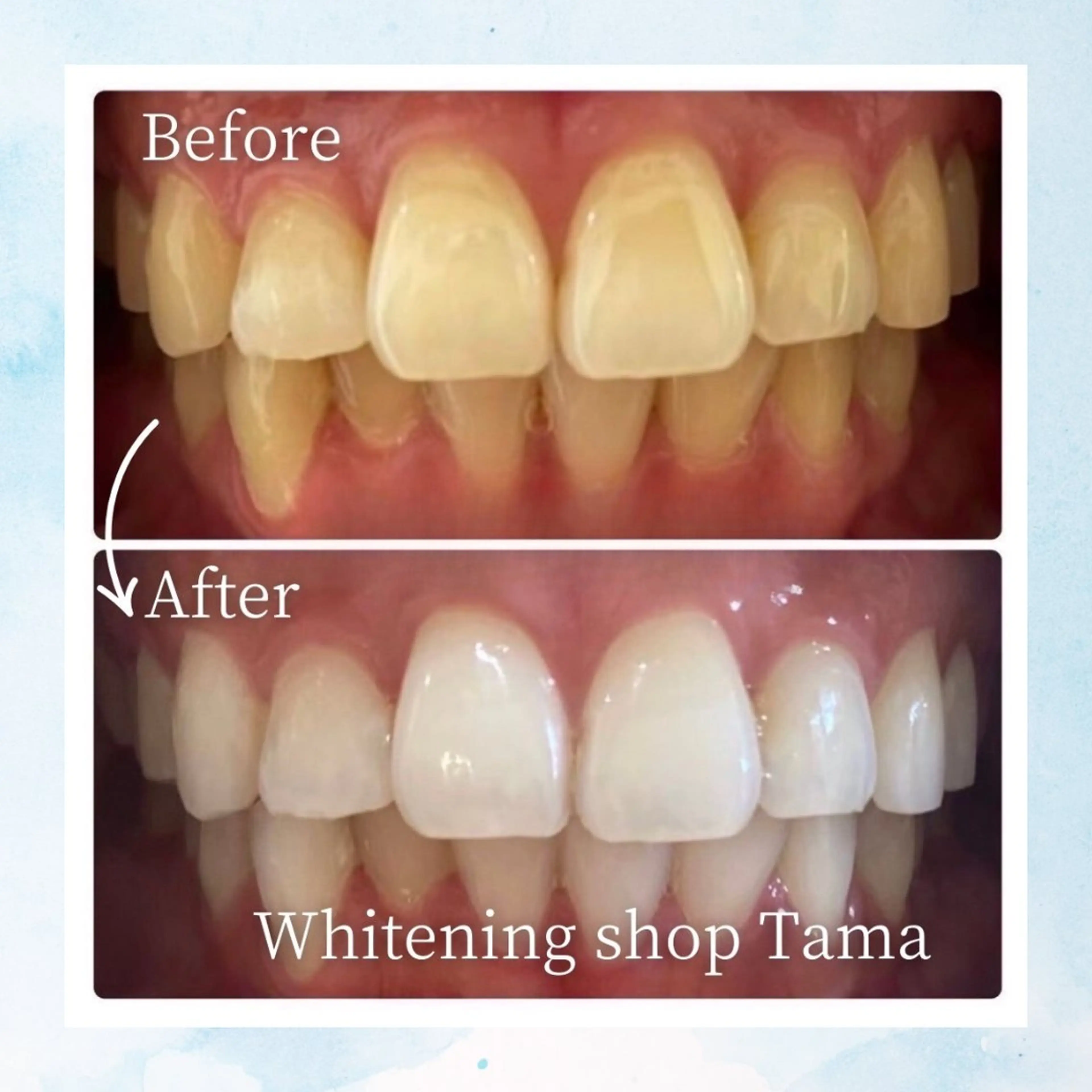 ホワイトニング ショップ多摩店のその他イメージ