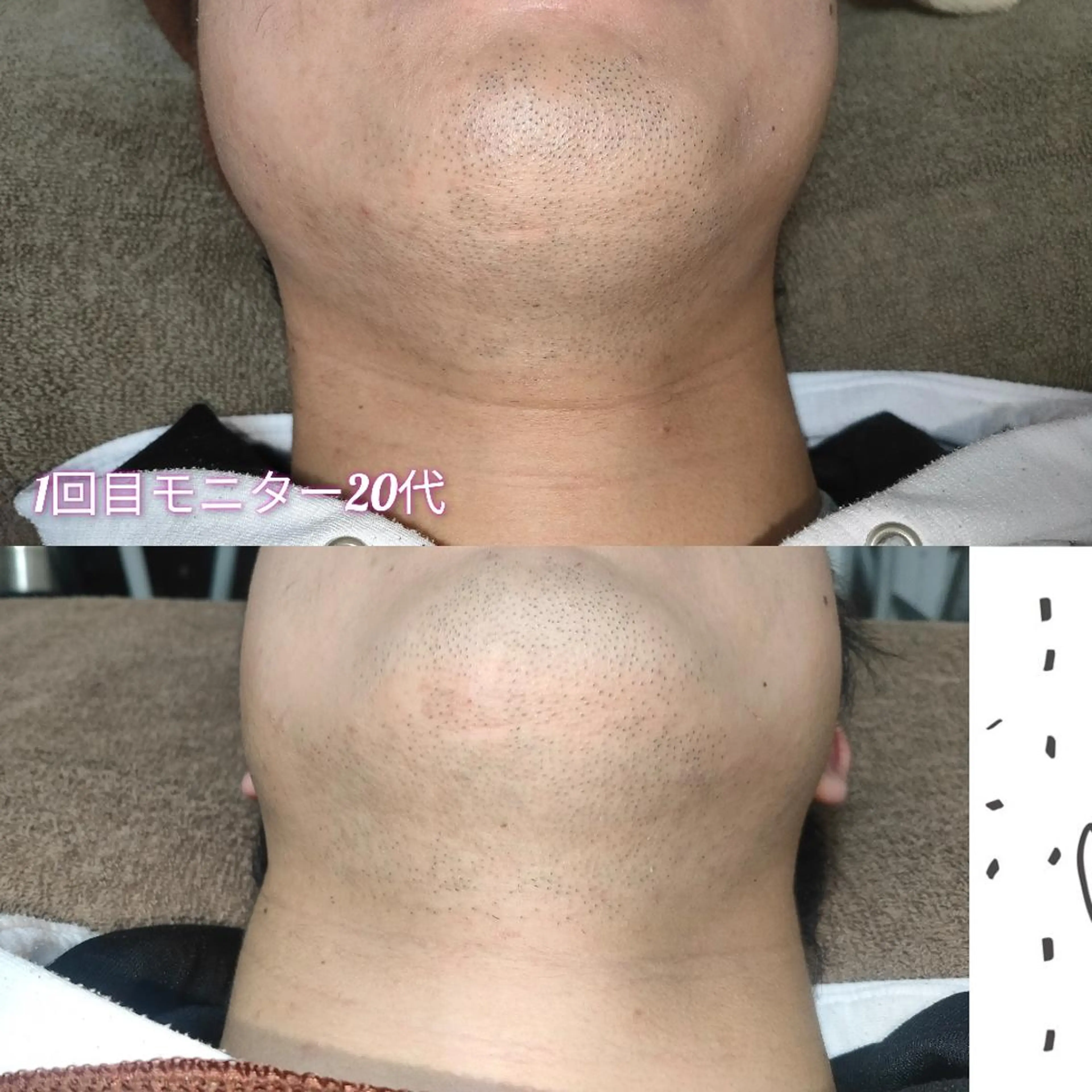 メンズ 脱毛 武 藤のエステ・リラクイメージ