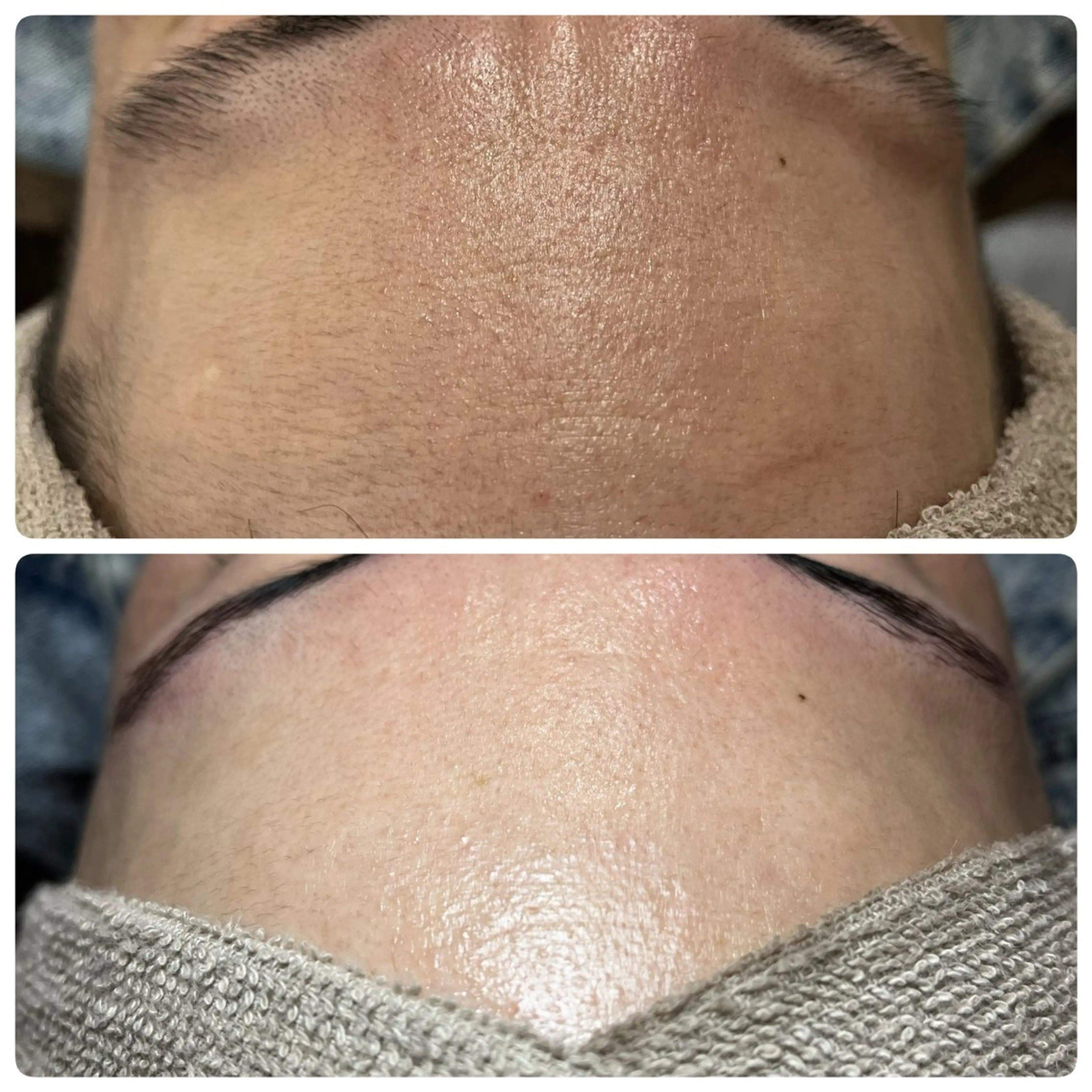 エステ A"-HILU （アーヒル)のエステ・リラクイメージ