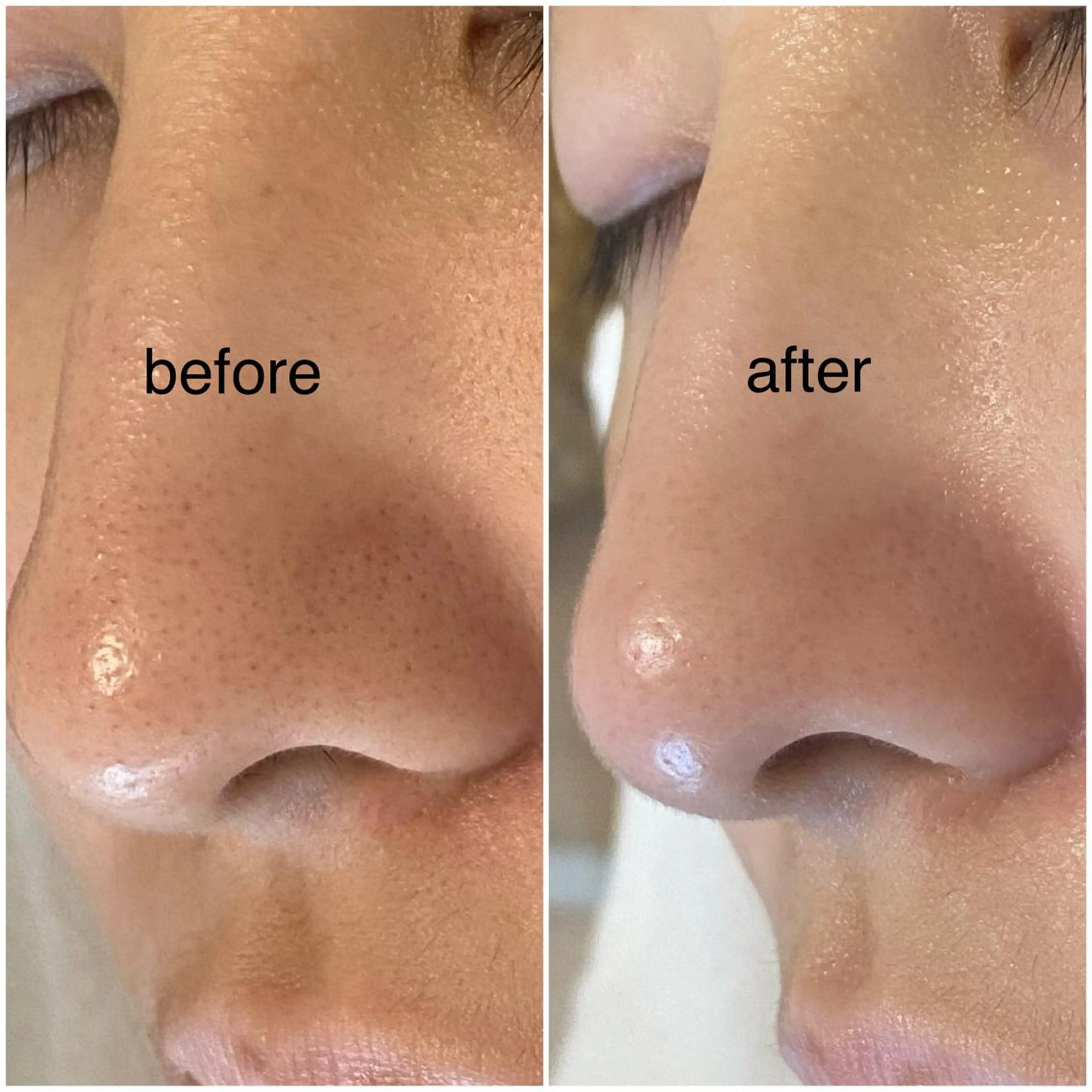 毛穴専門サロン　フルール所属・フルールFululu 自由が丘のエステ・リラクイメージ