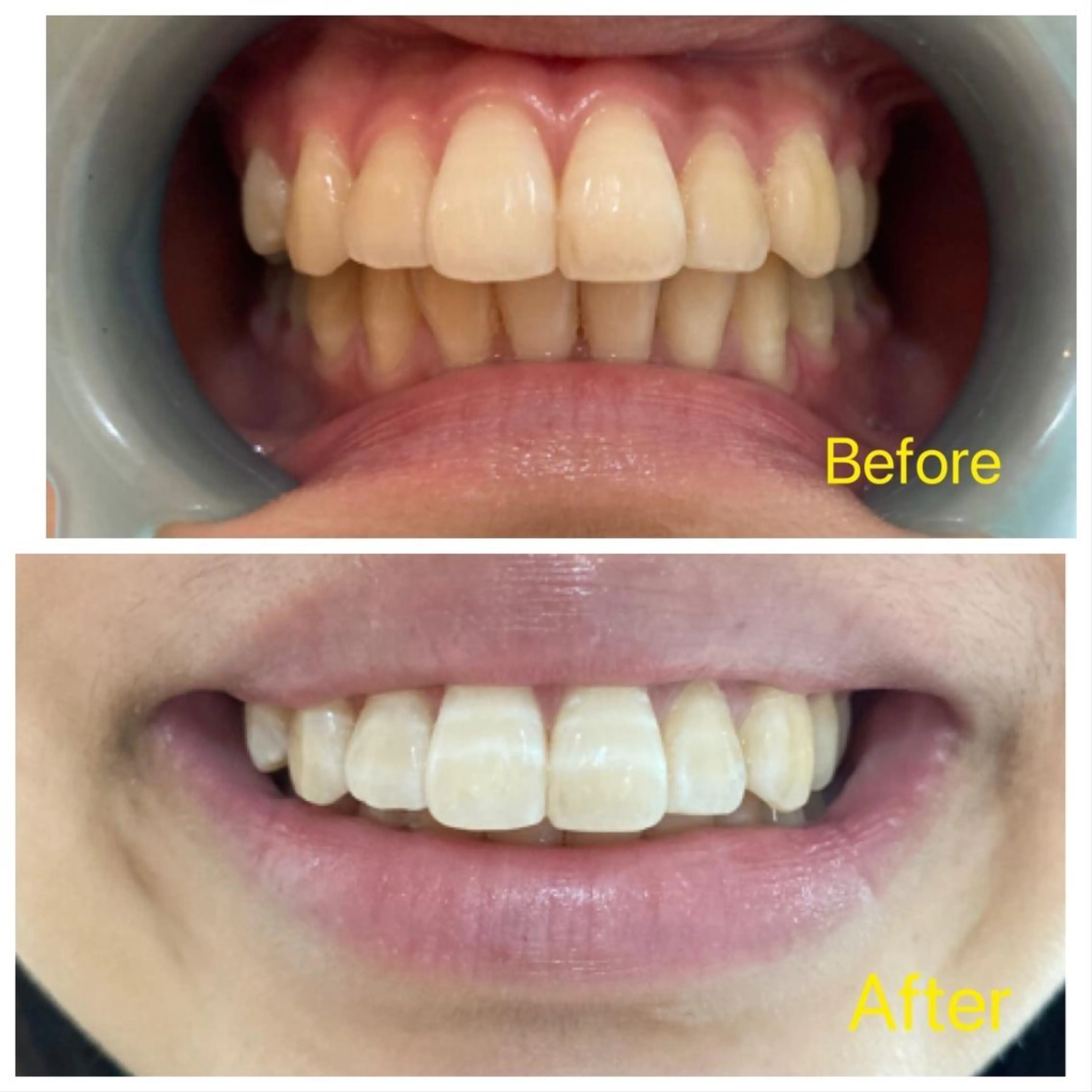 Ｍ渋谷 ホワイトニングのエステ・リラクイメージ