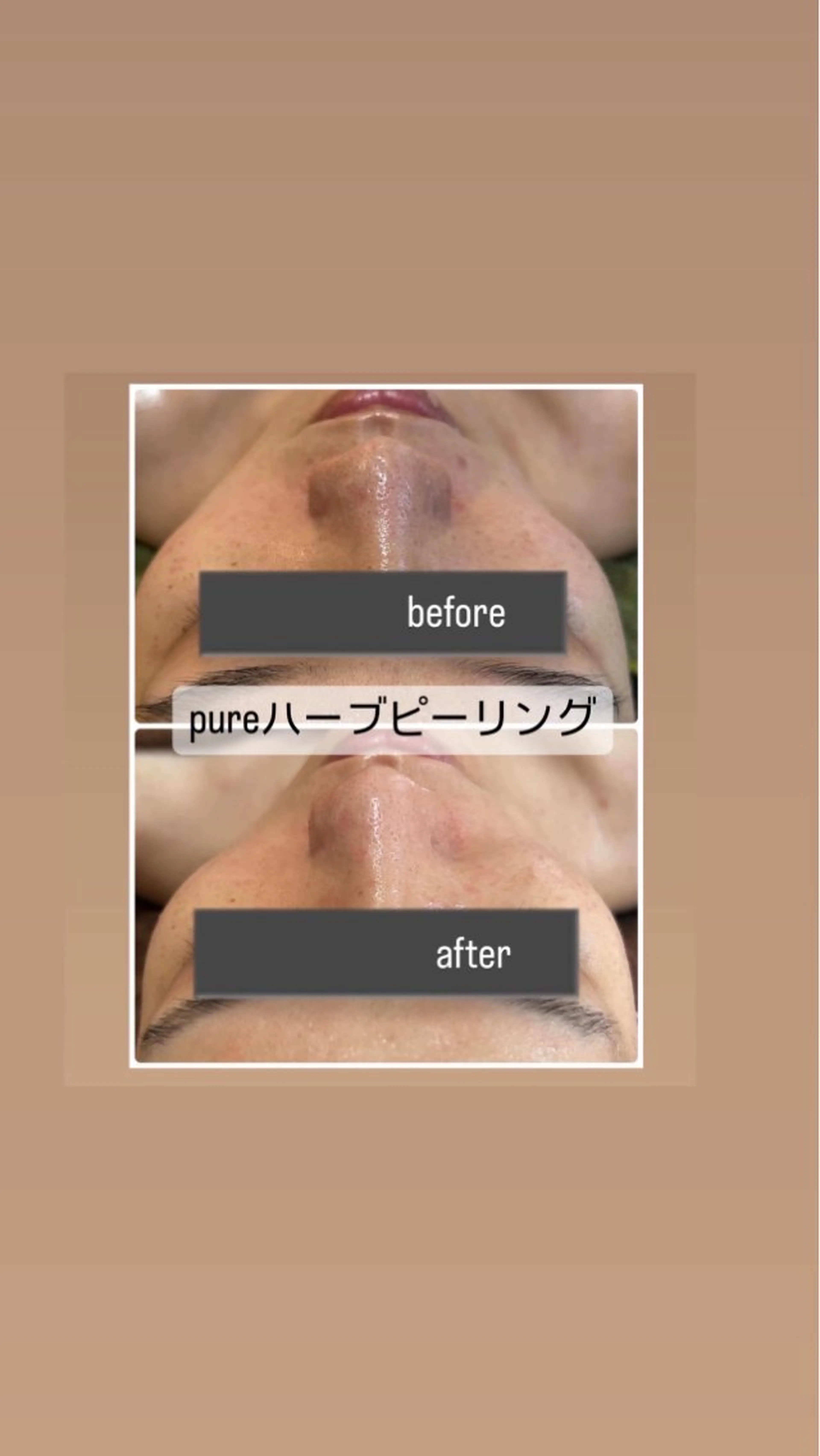 エステ ハーブ/小顔/リンパ /大阪狭山市のエステ・リラクイメージ