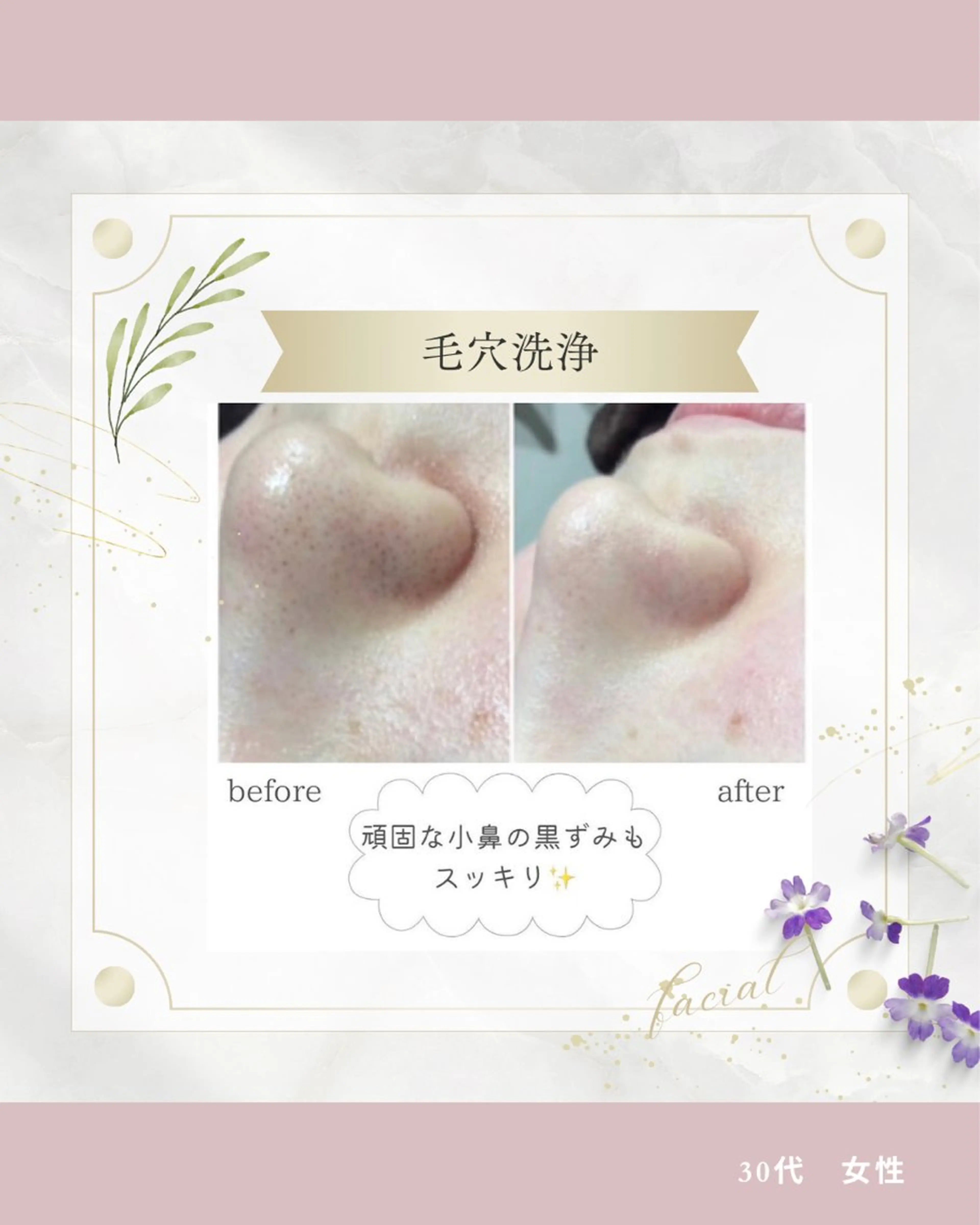 《 肌質×美肌 》 addissimoのエステ・リラクイメージ