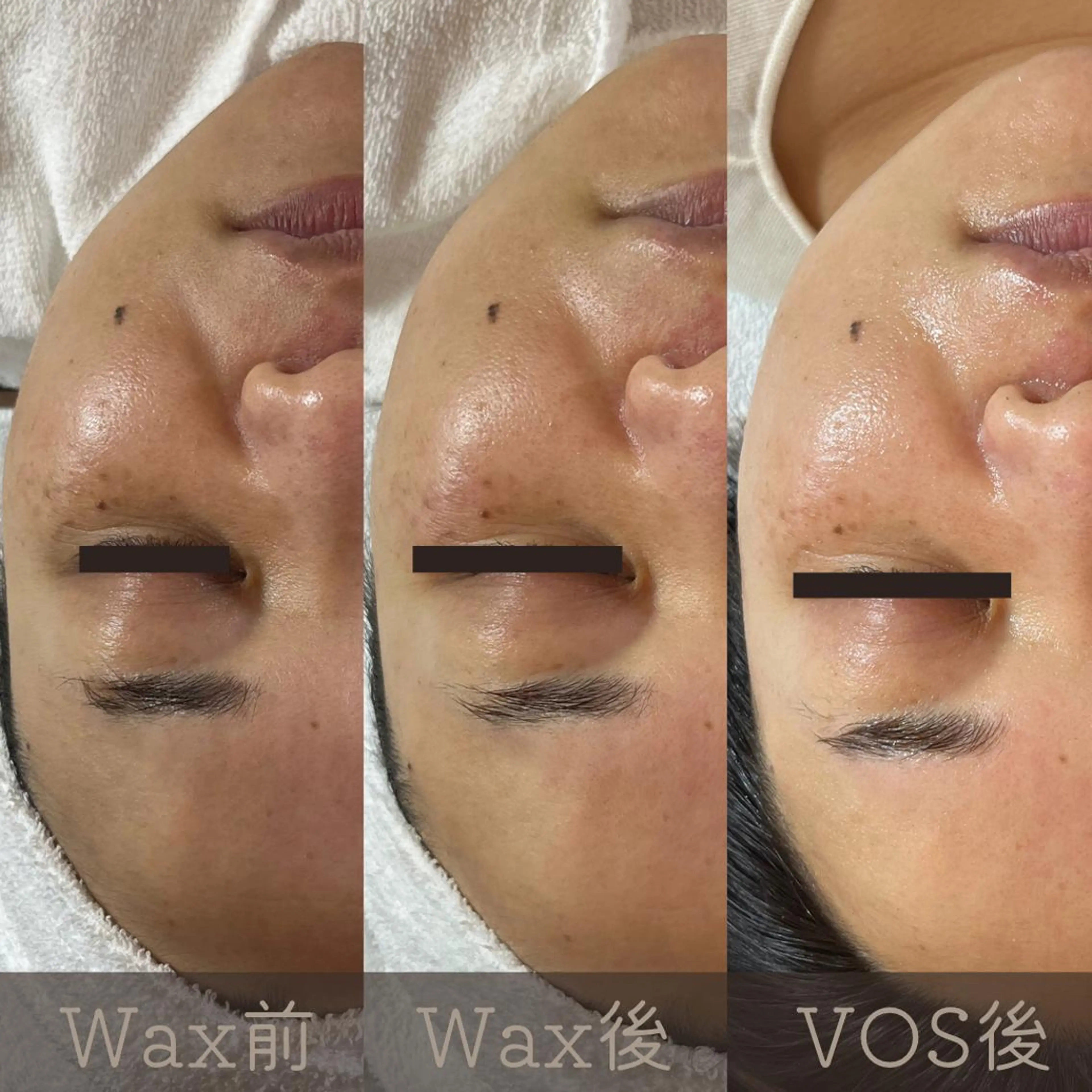 【相乗効果絶大 1回限り✨】最先端HARI美容 VOSサロンケア+お顔全体スーパーフードWax脱毛の写真