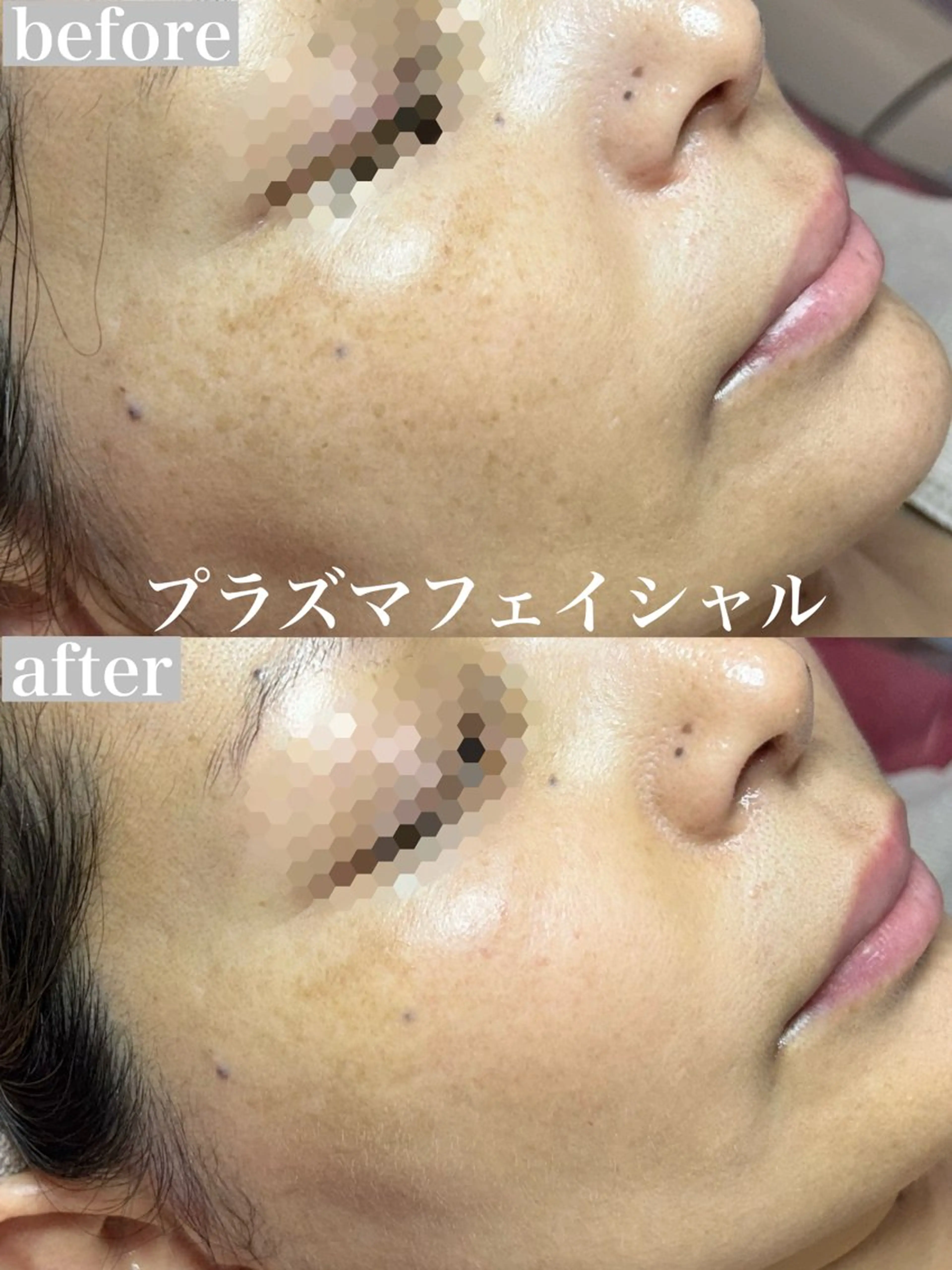 Nm'Rose(エミュローズ)所属・Nm'Rose .エミュローズのエステ・リラクイメージ